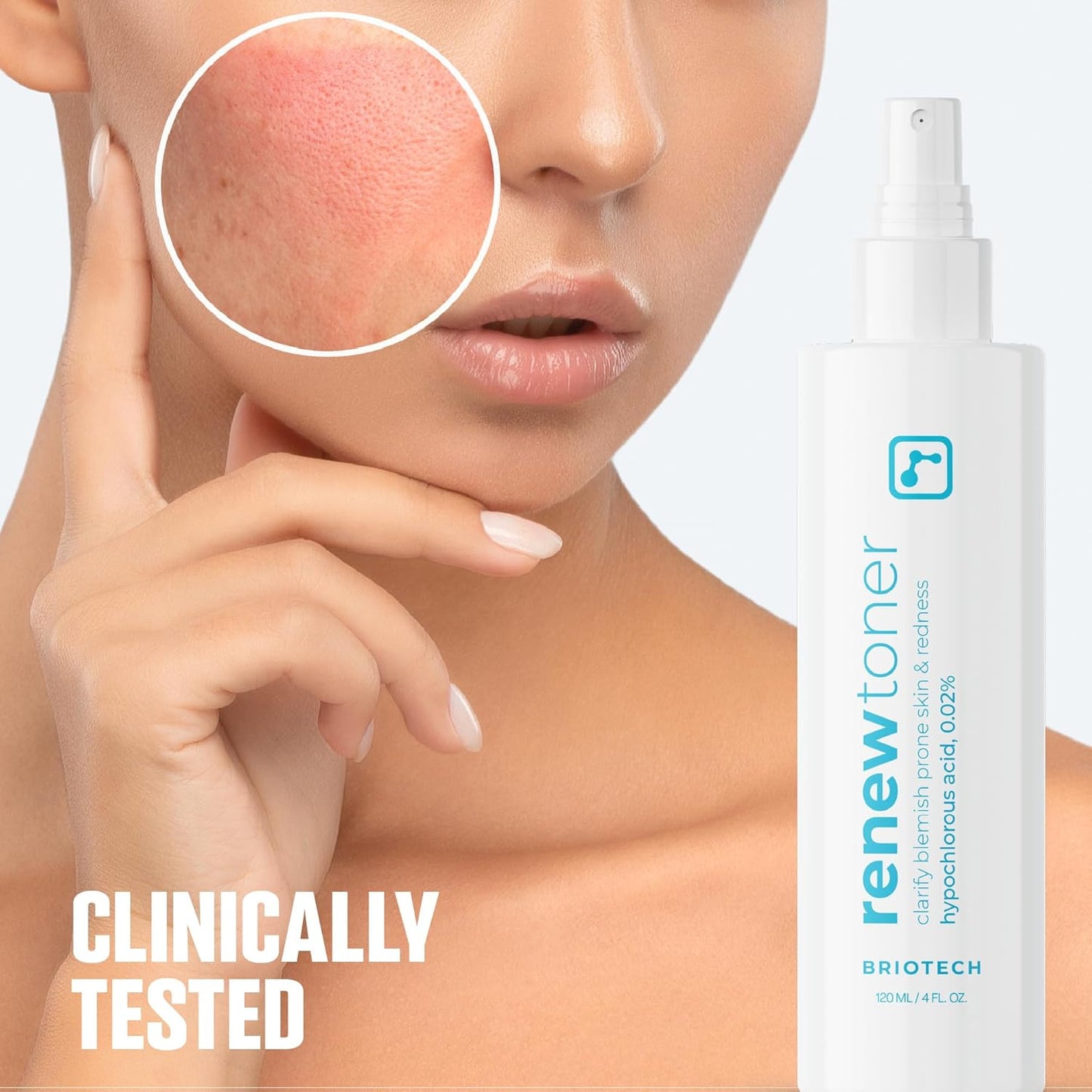 BRIOTECH Renew Toner, Hypochlorous Acid Spray, Minimize Appearance of Blemishes, Soothing Facial Mist for Sensitive Skin, Calm Redness & Bumps, Vegan, 4 fl oz (2 Pack)