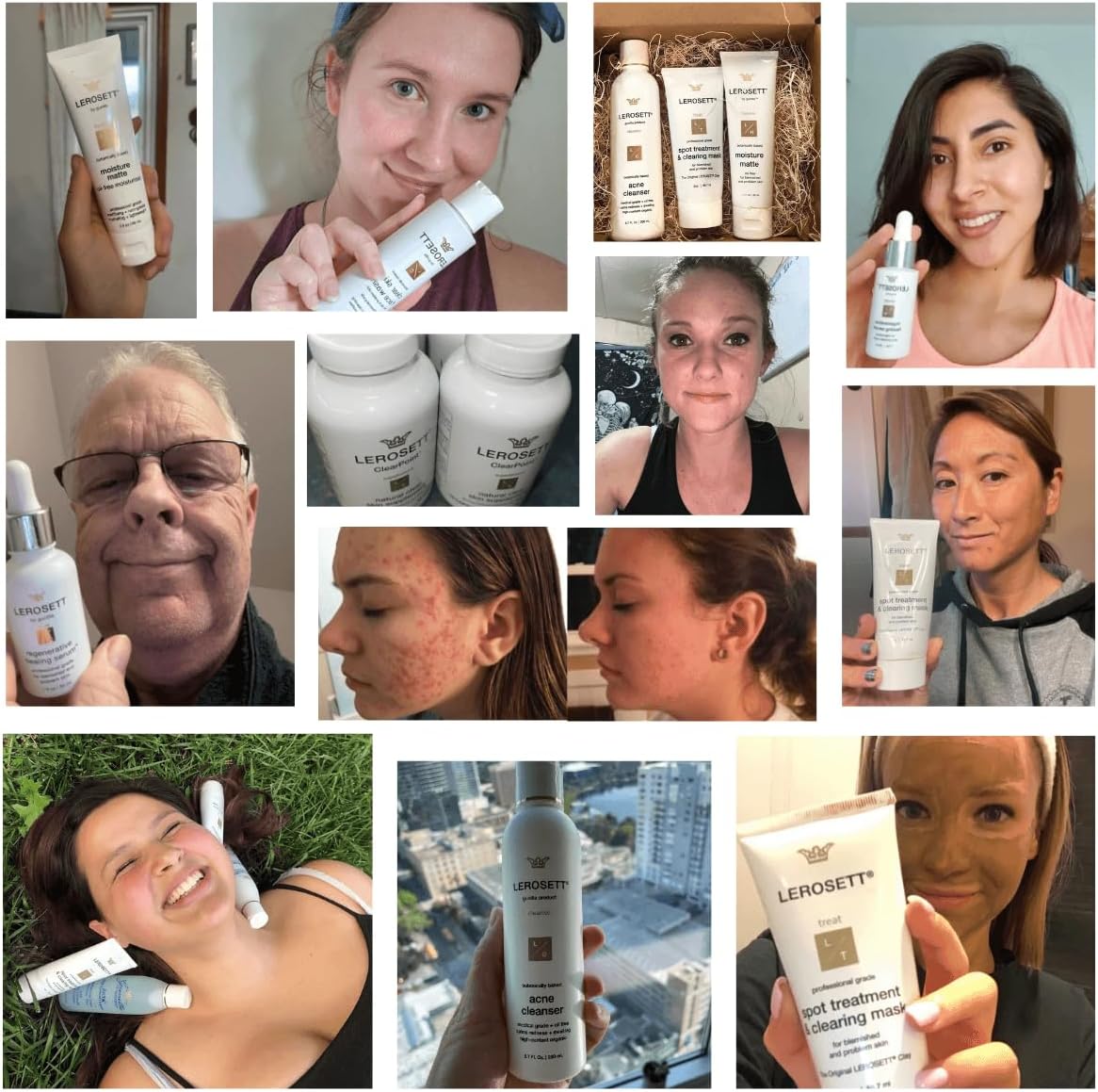 LEROSETT Toner for Clear Skin Aloe Vera Based Toner with Glycolic Acid & 10 Calming Botanicals Helps Reduce Irritation, Future Blemishes, Blackheads, and Tightens Pores, Natural, Vegan - 4 oz