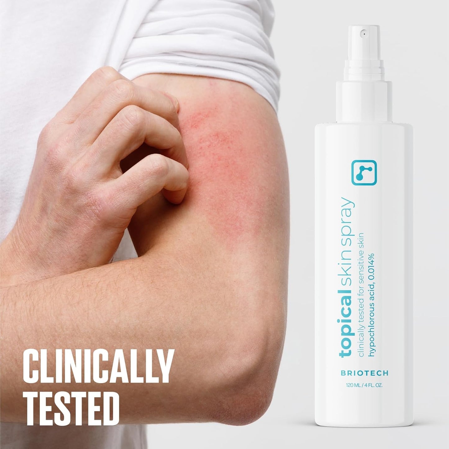 BRIOTECH Topical Skin Spray, Hypochlorous Acid Spray for Sensitive Skin, HOCl Facial Mist, Full Body Support Against Irritation, Calm Redness, Soothe Foot & Scalp, 4 oz