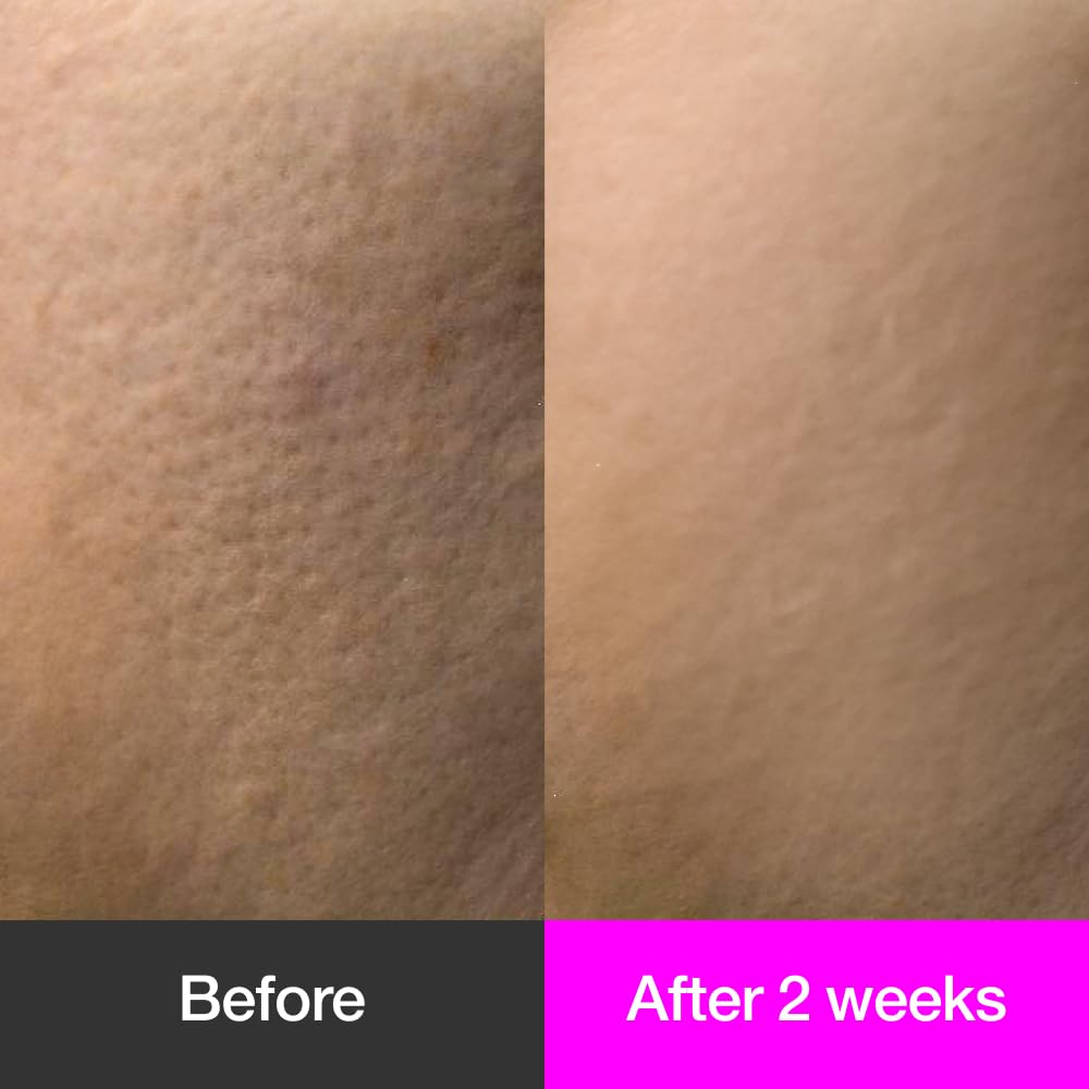 Black Cherry Pore Tightening Cream Luftig, Pore Minimizer, Black Cherry Extract, AHA, Hydrolyzed Collagen, Korean Skincare, All Skin Types, 3.3 fl.oz / 100ml