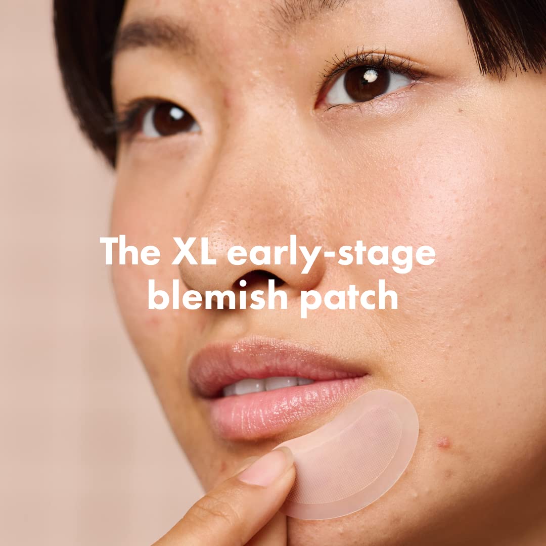 Mighty Patch Micropoint Large Hydrocolloid Pimple Patches for Face Blemishes from Hero Cosmetics, Acne Stickers for Early Stage Zits & Hidden Pimples, 1,385 Proprietary Micropoints, 6 Count