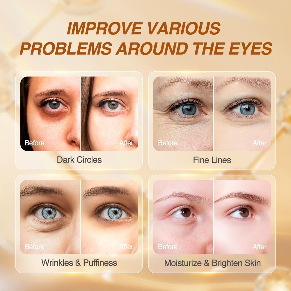 5% Caffeine Eye Serum Anti Aging, Eye Cream Reduce Dark Circles, Puffiness, Fine Lines, Wrinkles, Hyaluronic Acid Niacinamide Eye Moisturizer with 360° Massage Ball, Eye Balm for Men& Women