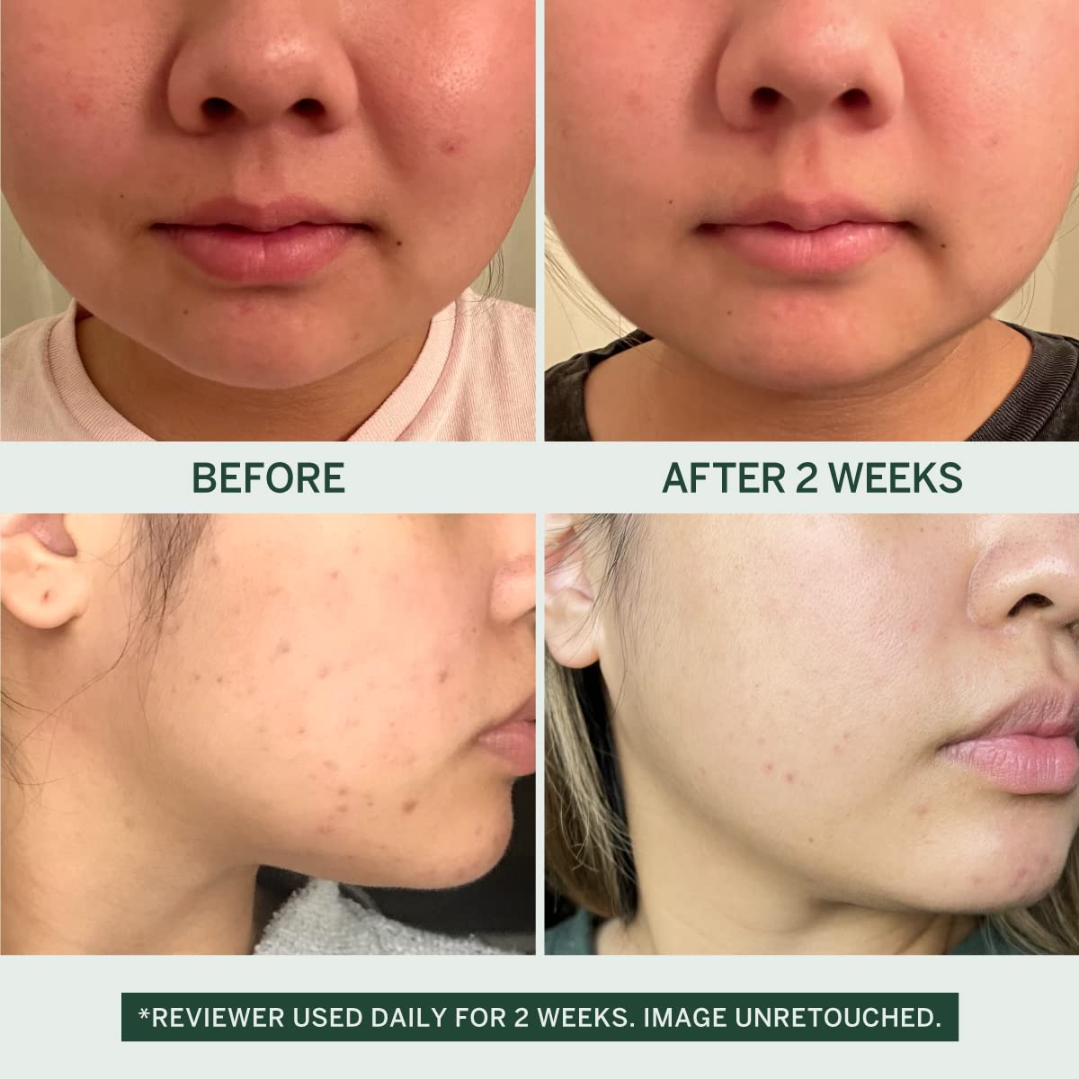 Urban Calm Collection Gift Set - Hydrating, Smoothing, Exfoliating, and Soothing Skincare Set for All Skin Types - Includes Fermented Skincare Products: Cleanser, Essence, Serum, and Cream