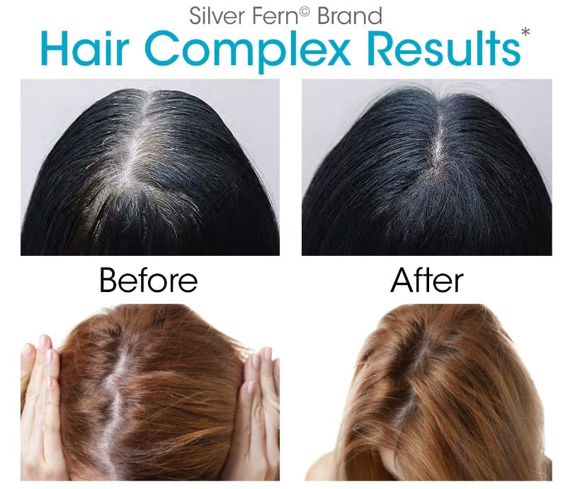 Silver Fern Hair Complex Hair Supplement for Promoting Healthy Hair - Each Bottle Contains 30 Days of Powder Supply - 2 Bottles