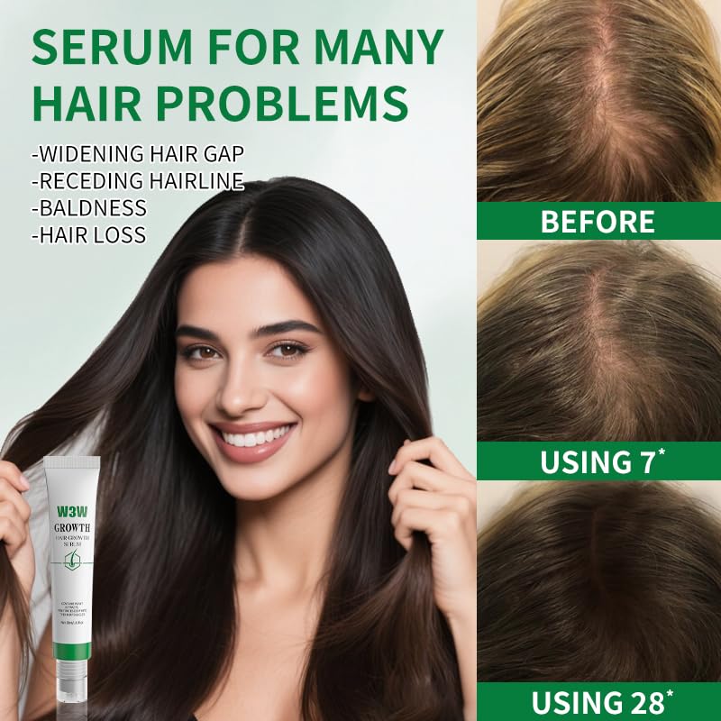Hair Growth Serum for Scalp - Hair Serum for Hair Growth Accelerates, Strengthens & Thickens Hair Nourishing Formula with Caffeine Non-Greasy Hair Regrowth Treatment Prevents Hair Loss & Thinning