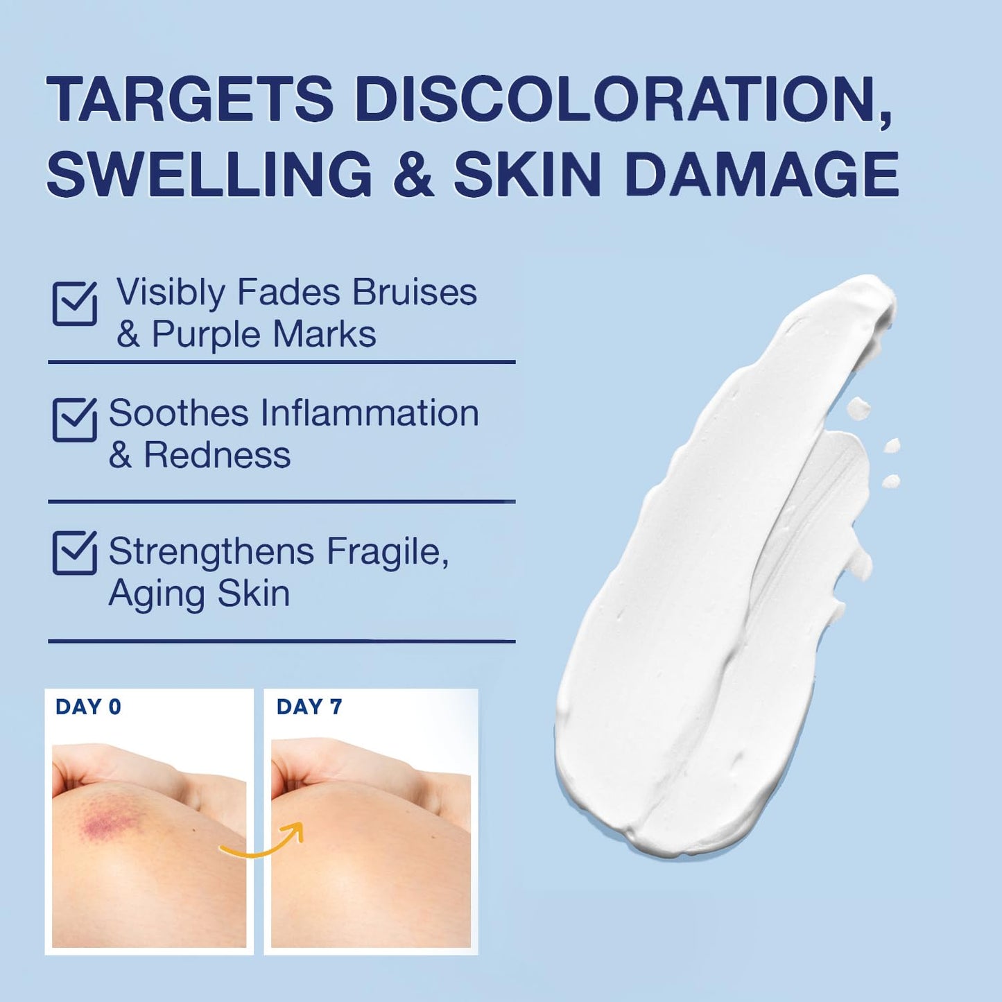 Arnica Bruise Cream Extra Strength – Fast Healing Arnica Montana with Vitamins K, C & E for Bruising, Swelling, Discoloration & Thin Skin – Hydrating Moisturizer for Face & Body – 4 oz