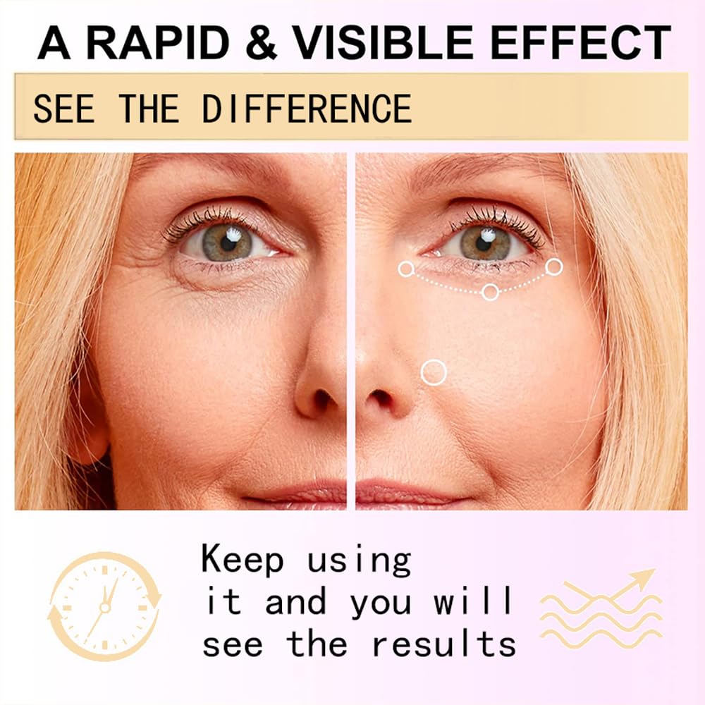 New Snail Peptide Eye Cream for Fine Lines, Dark Circles and Puffiness, With 73% Snail Mucin Filtrate & 2% Nicotinamide, Moisturizing, Hydrating, Firming, Brightening, 360° Massage Ball; YS-WN