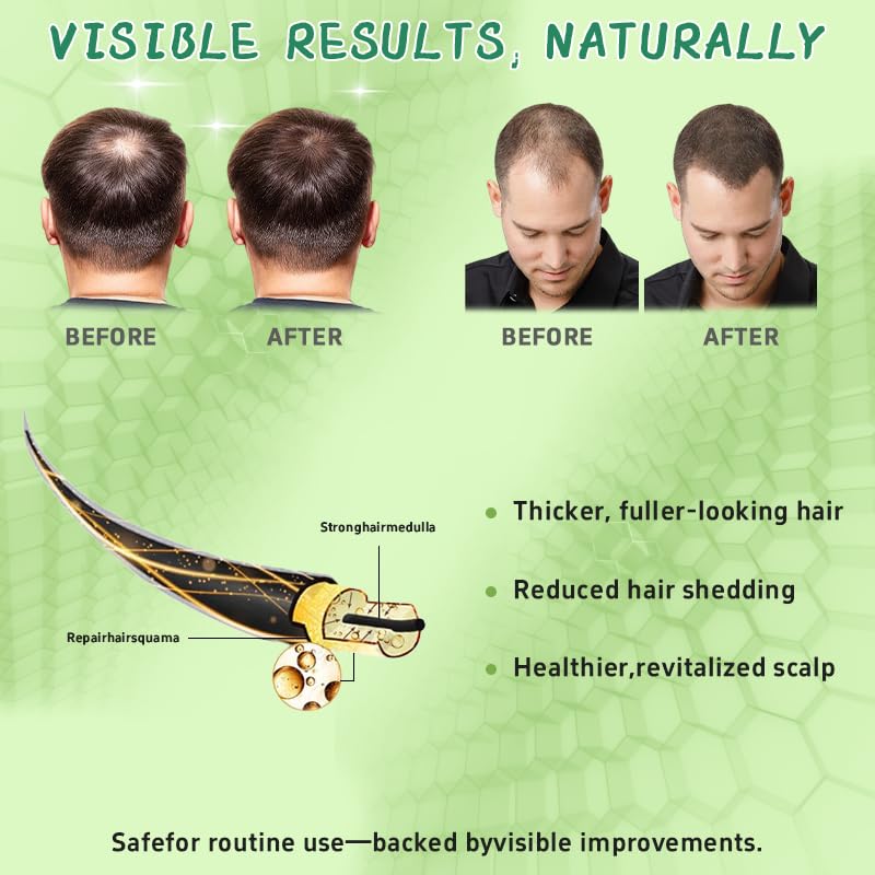 Hair Regrowth System – Advanced Hair Growth Treatment for Men & Women with Ginseng, Eclipta Prostrata, Peppermint & Ginger Root – Thickening Serum for Thicker, Fuller Hair – Natural Hair Loss Solution
