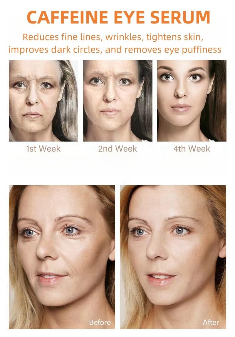 Caffeine Solution 5% + EGCG, Caffeine Eye Serum For Face, Moisturizing Under Eye Solution For Reduces Dark Circles & Puffiness, 30ML (1, 1 PC)