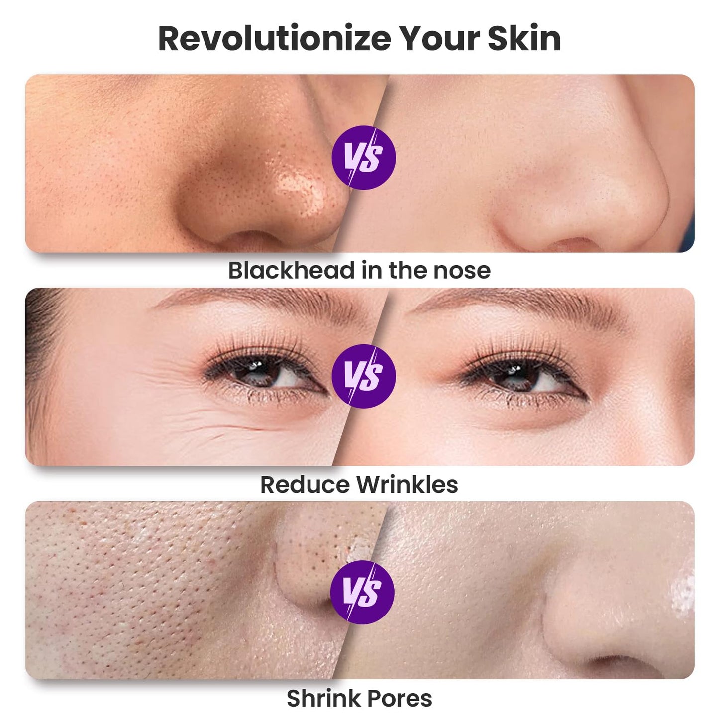 Diamond Microdermabrasion Machine, UNOISETION Rechargeable Micro Dermabrasion Facial Tool with 12 Diamond Tips, Blackhead Remover for Home Travel