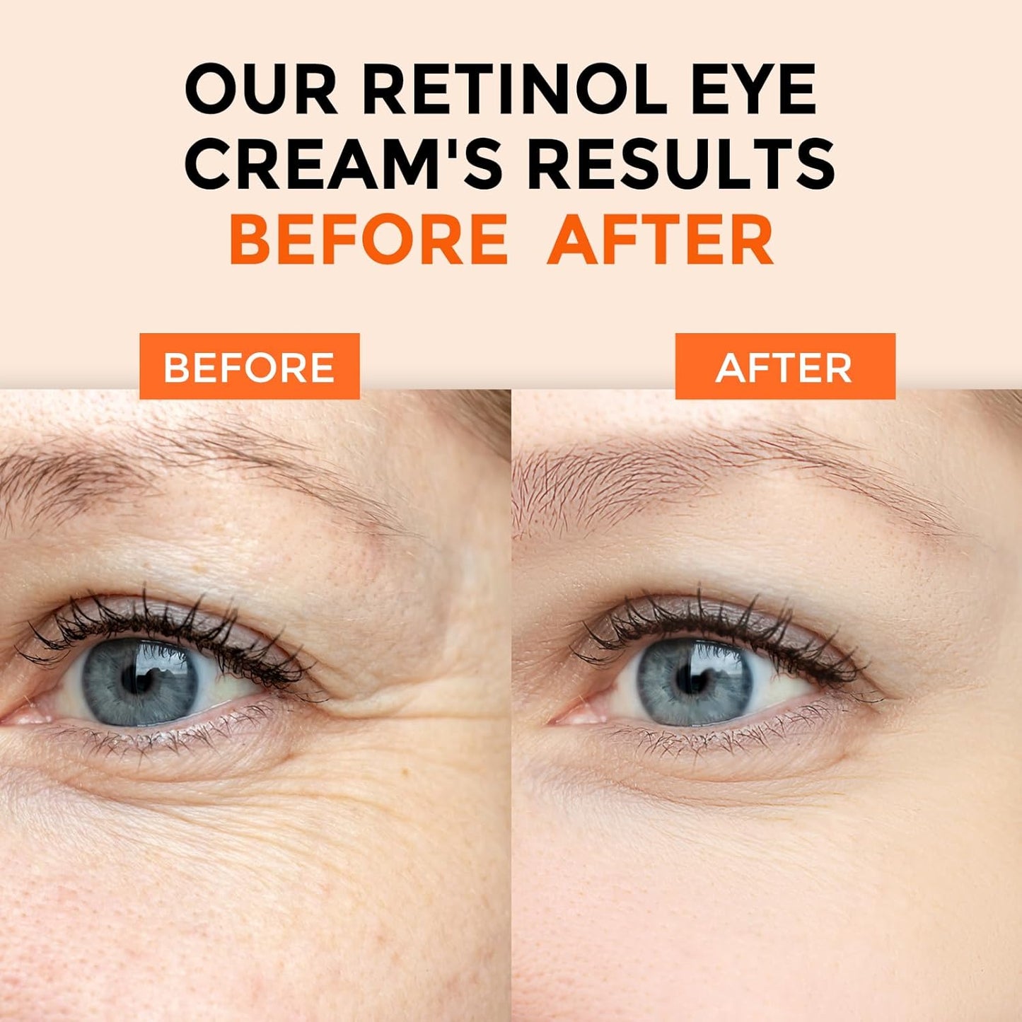 Retinol Eye Cream for Dark Circles and Puffiness, Anti Aging Under Eye Cream with Hyaluronic Acid, Retinol & Collagen to Fight Fine Lines, Wrinkles & Dark Spots