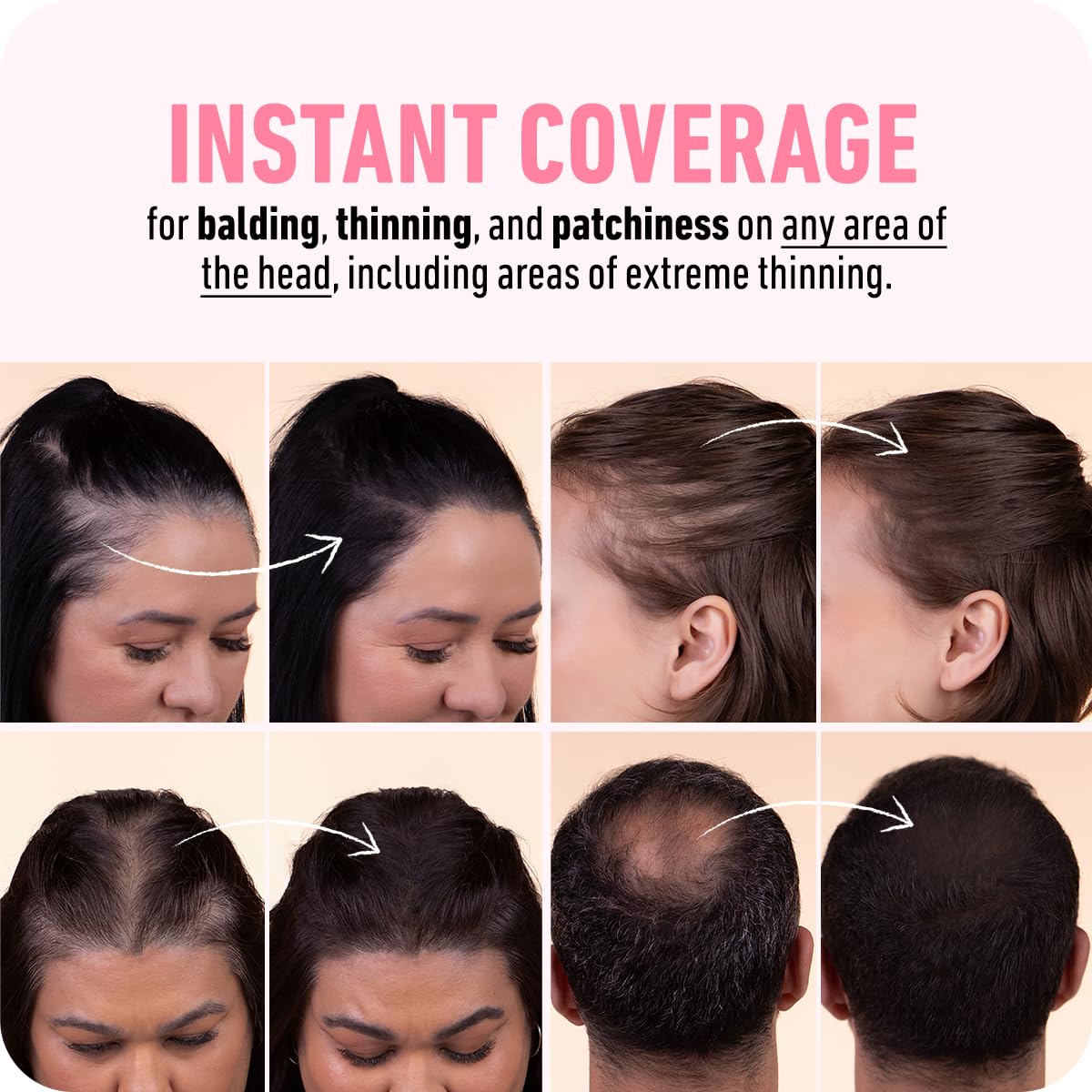 BOLDIFY Hairline Powder (LARGE, 10g) - Root Touch Up Hair Color for Gray Coverage - Bald Spot Concealing Hair Powder for Women & Men - 48-Hour Stain-Proof - Black