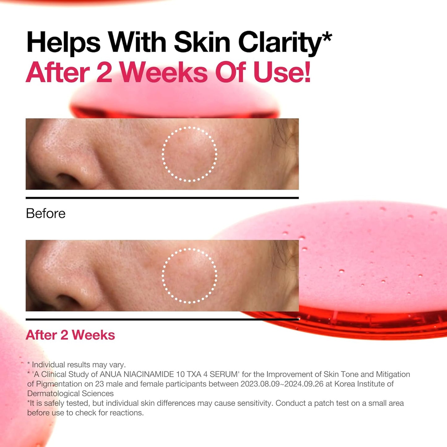 ANUA Niacinamide 10 + TXA 4 Serum, Hyaluronic Acid, Tranexamic acid, Facial Serum for Glass Skin, Clarifying, Radiant Complexion with Natural Color, Korean Skin Care (30ml /1.01 fl.oz)