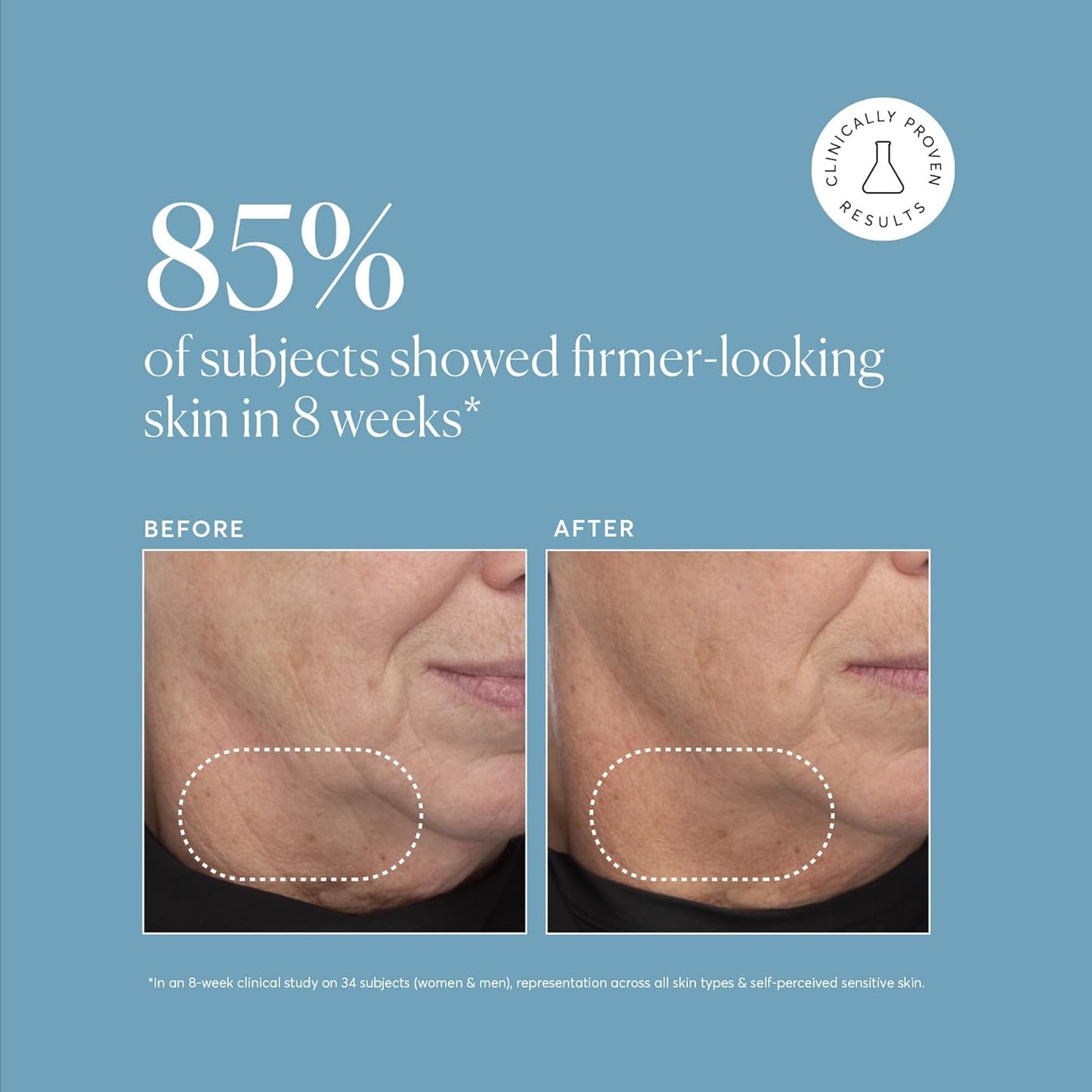 Naturium Retinol Complex Serum, Encapsulated Retinols & Bakuchiol, Refining & Smoothing Facial Serum, 1 oz