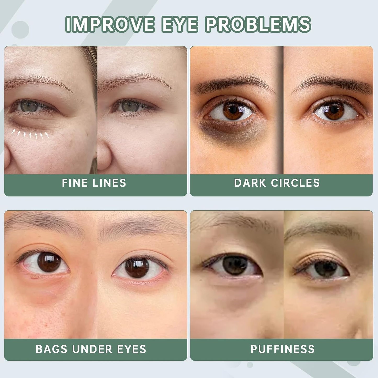 Caffeine Eye Serum for Reducing Puffiness and Dark Circles - 1Pcs Caffeine Solution 5%+EGCGE(30ml).