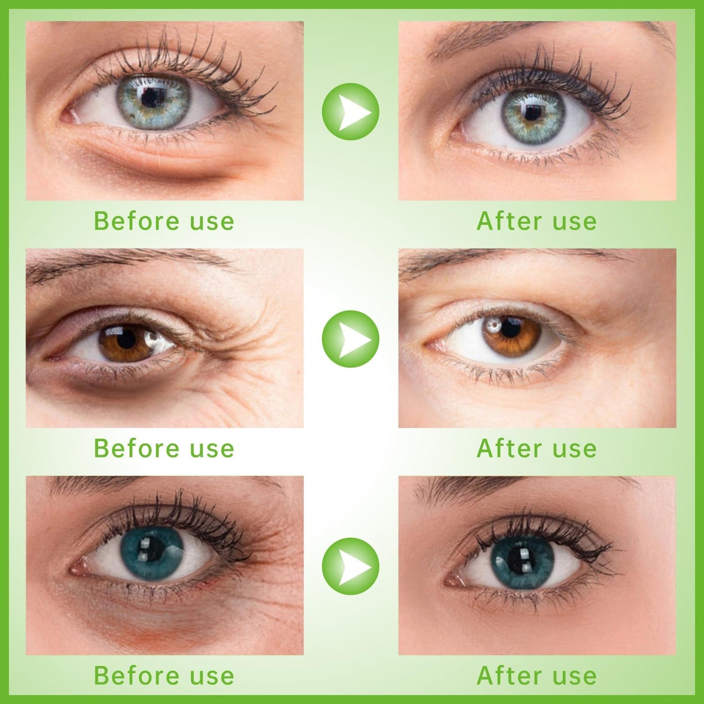 Gel Eye Ice Pack Reusable Cooling Ice Eye Pads and Under Eye Patches, Eye Hot Cold Pack for Eye Relax,Swelling, Eye Redness, Puffy Eyes (Lemon)