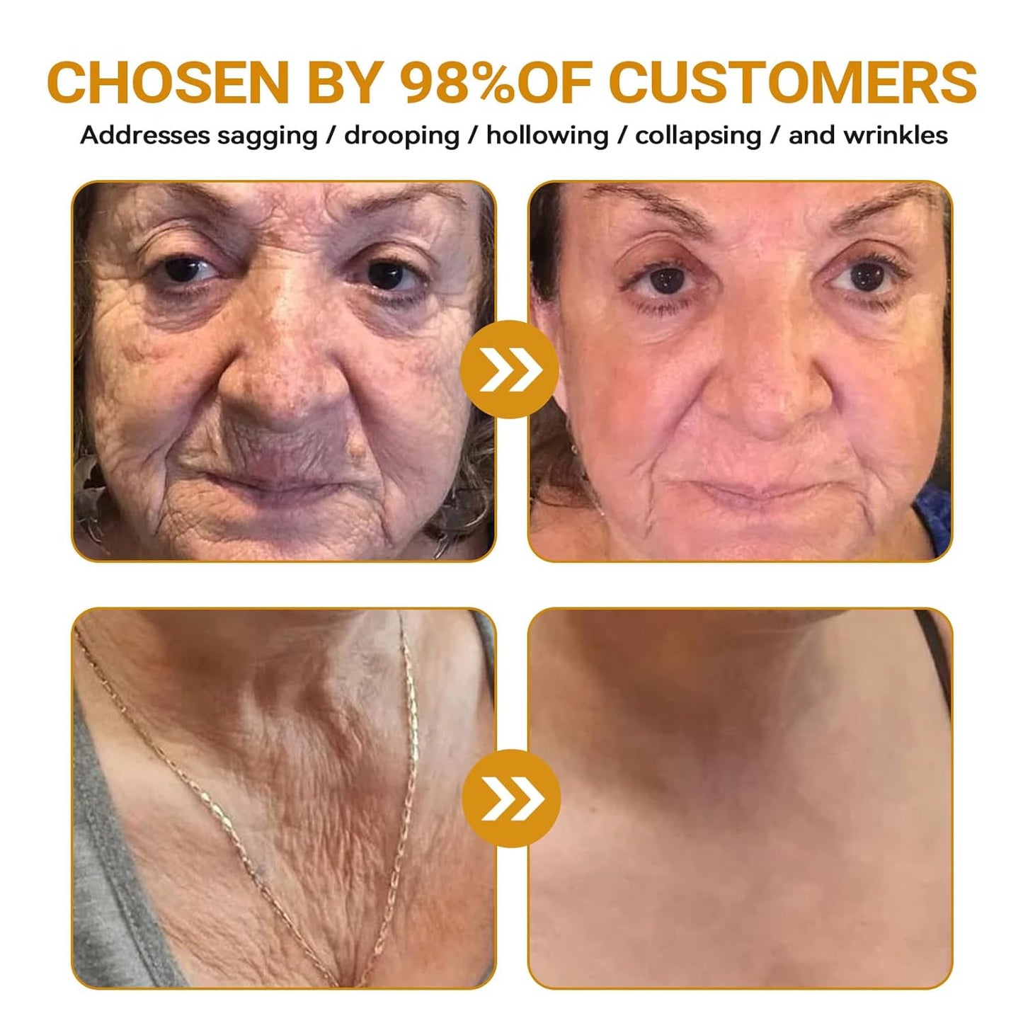 LipMaps Bee Venom Skin Restoration Cream, Bee Venom Skin Treatment Cream, Repair skin and Firming, Effective In Reducing Blemishes (2)