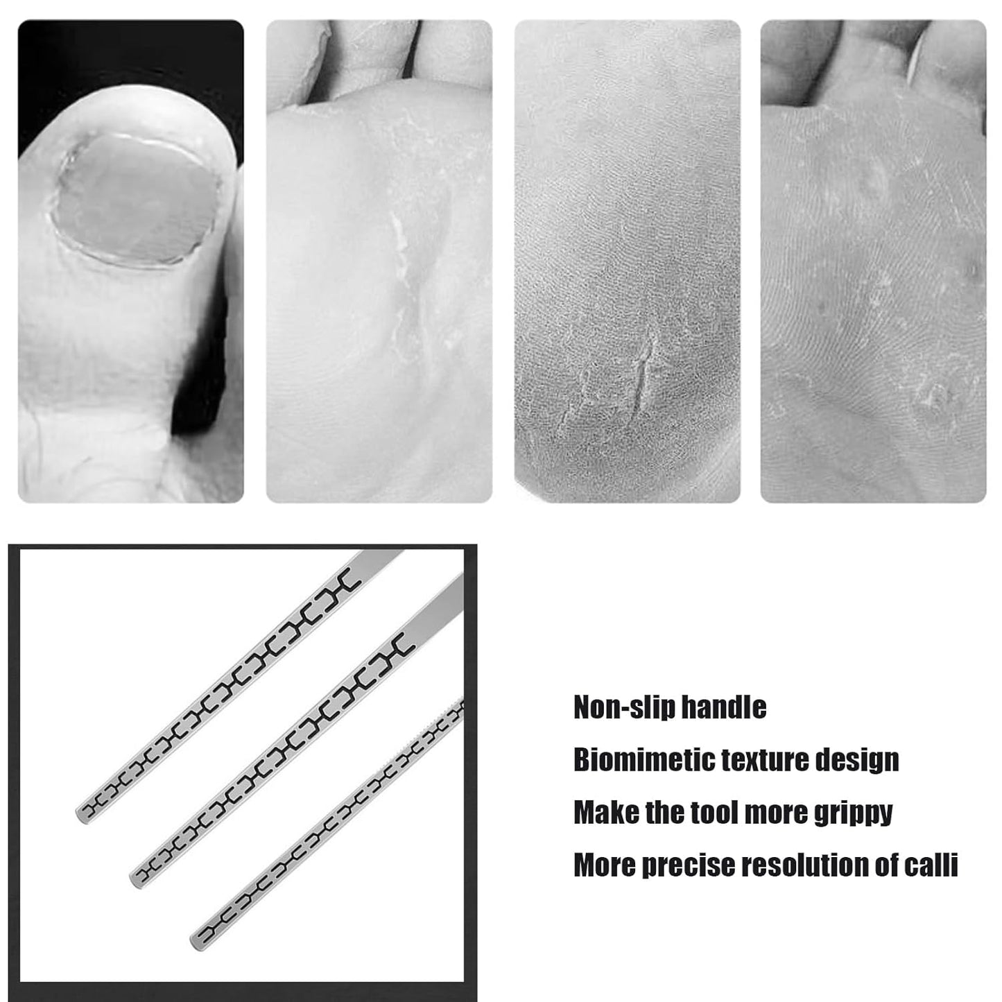 Stainless steel ingrown toenail pedicure knife set,professional foot skin scraper repair sharp blade kit for nail corn callus paronychia treatment. (4)