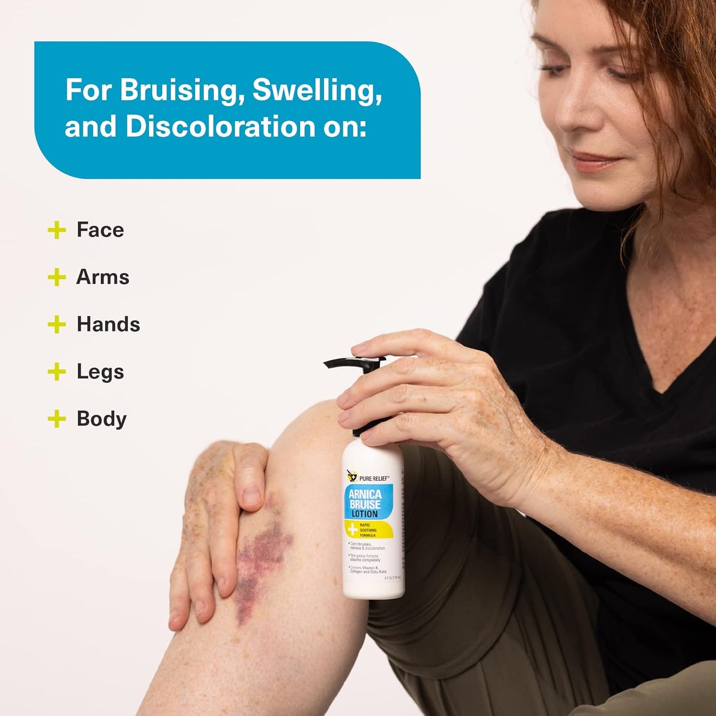 Arnica Bruise Relief Lotion for Bruising, Swelling, & Discoloration On Skin, Natural Skin Care Arnica Bruise Homeopathic Topical Bruise Cream W/Aloe Vera & Collagen, 4 Fl Oz (Pack of 3)