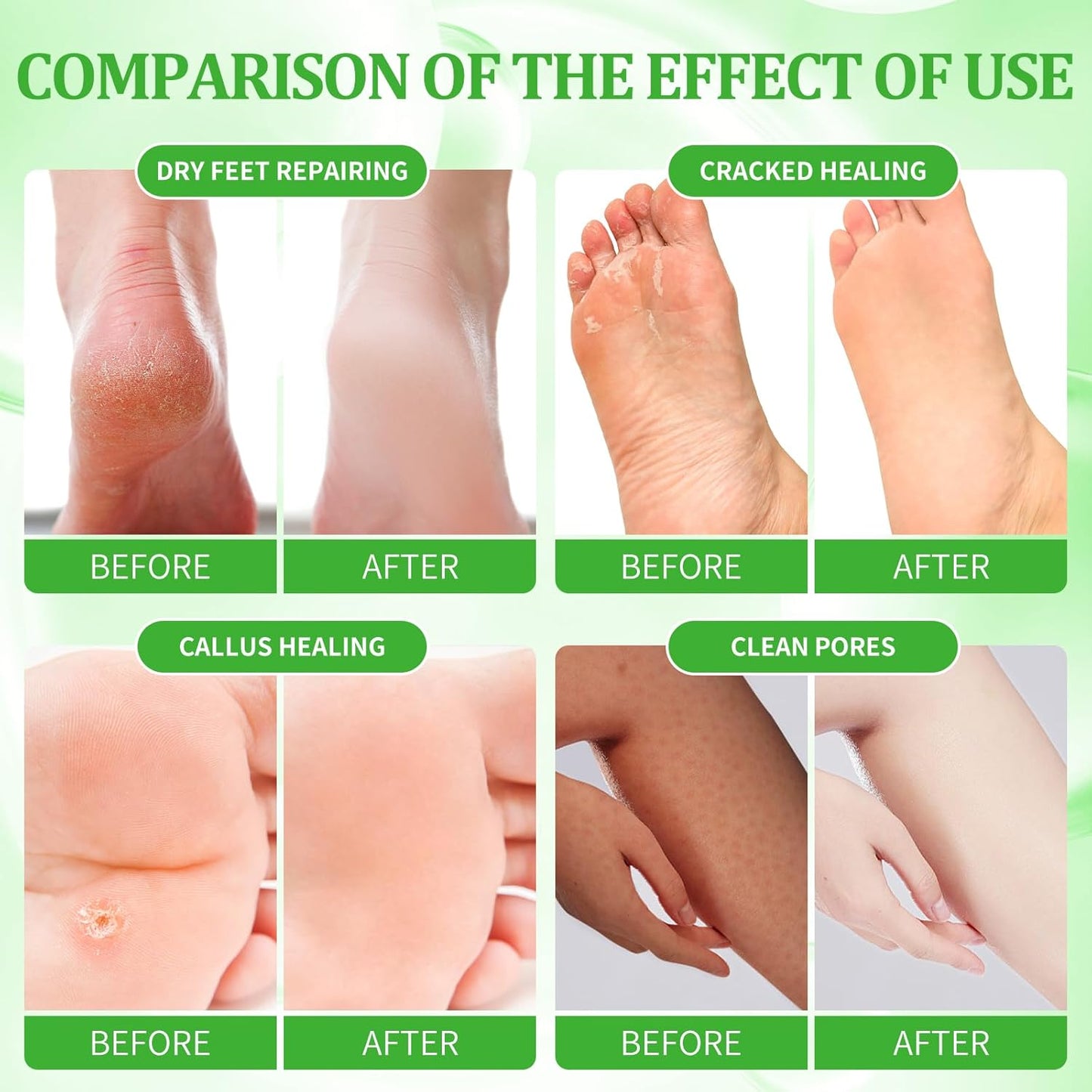 Pedicure Kit Foot Soak Set: Bubble Salt, Sugar Scrub, Massage Mask, Massage Lotion in a Box, 4 Step Foot Spa Kit for Dry Feet, Calluses and Tired Feet（3 Set Peppermint）