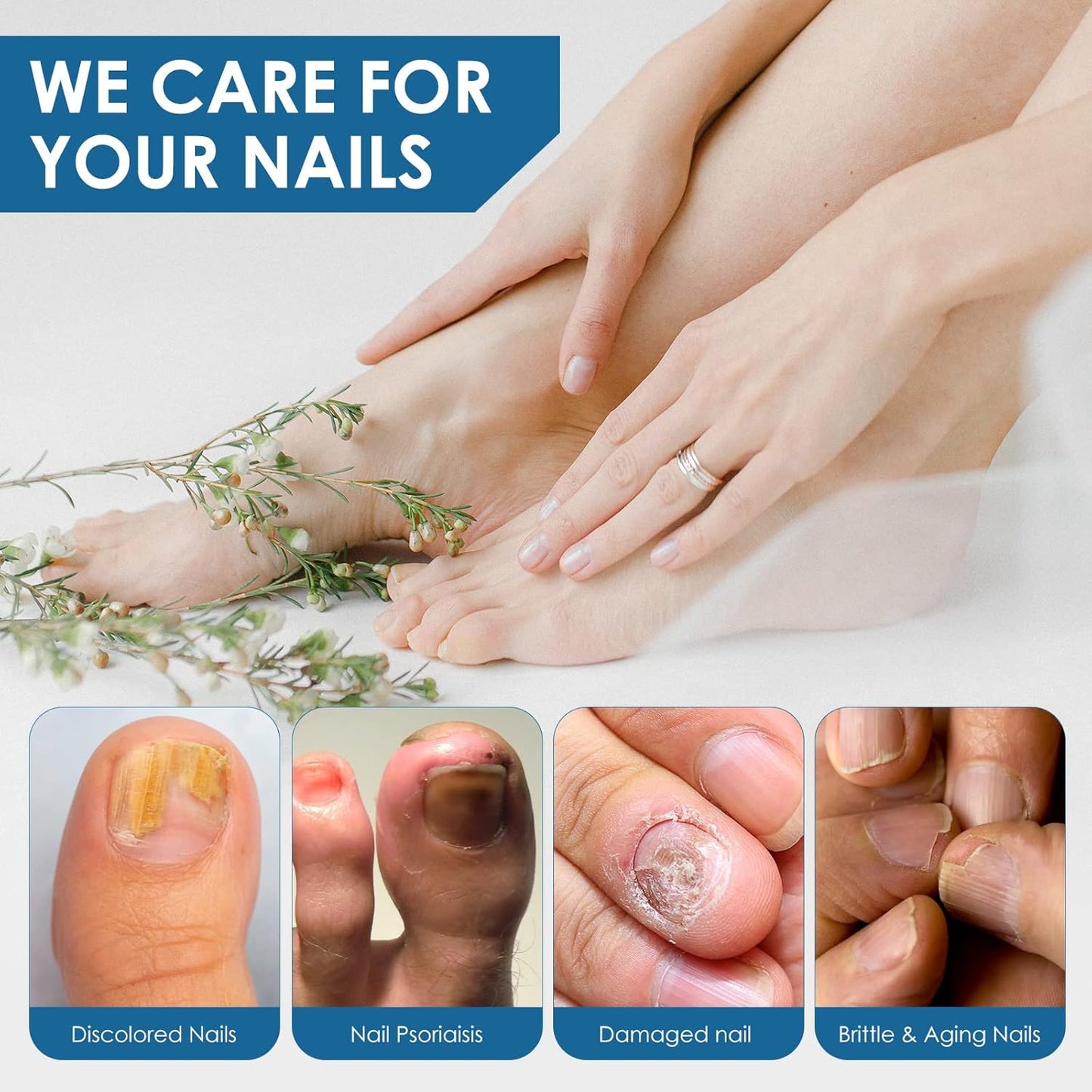 Toenail Repair Treatment, Extra Strength Nail Repair Liquid with Natural Tea Tree Oil Extract, Toenail Repair Solution for Thickened and Ingrow Nails