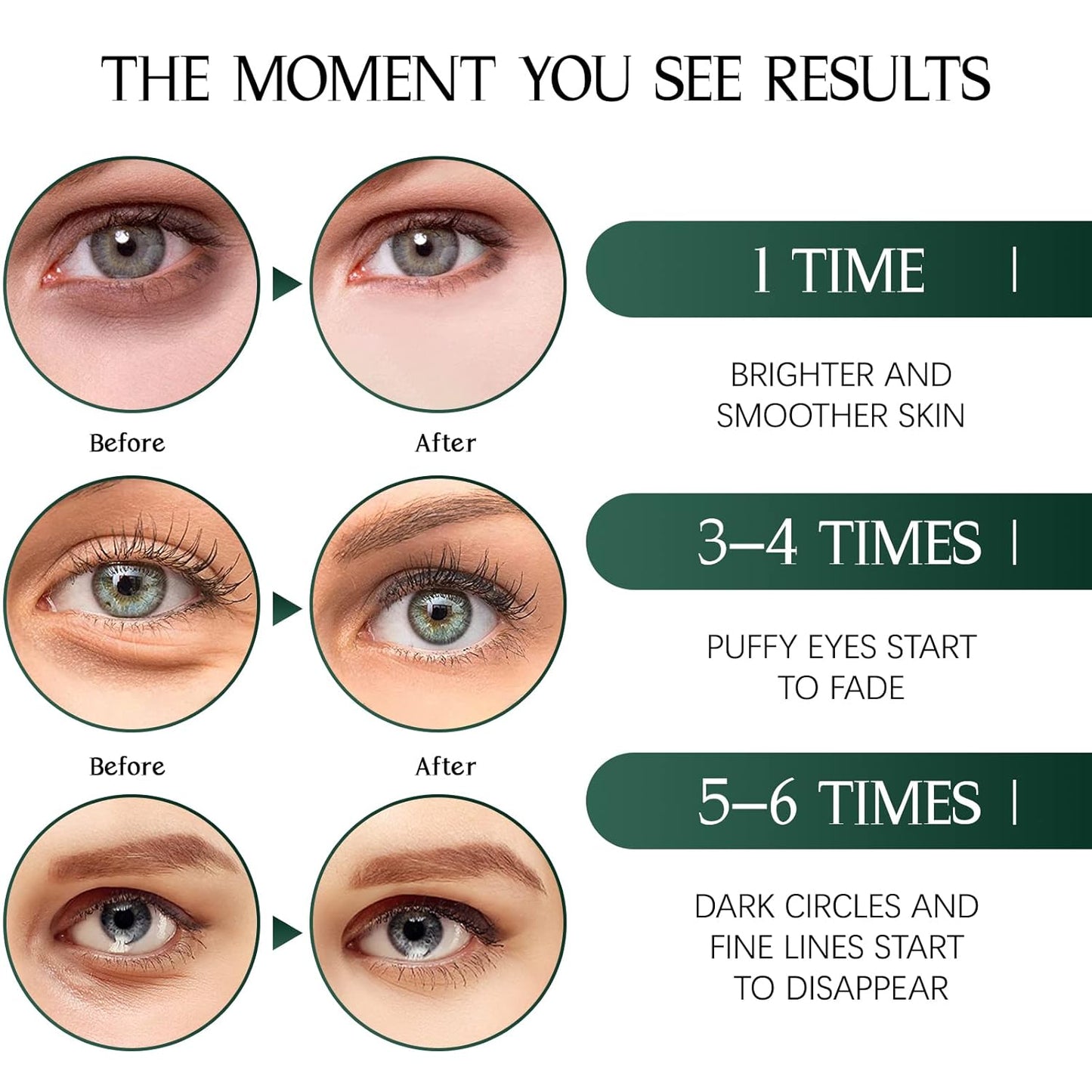 Tiepetly Under Eye Masks, Collagen Eye Mask, Green Tea Eye Patches for Puffy Eyes 60 pcs, Under Eye Patches for Dark Circles and Puffiness, Hydrating Eye Mask Skincare, Eye Gel Pads for Eye