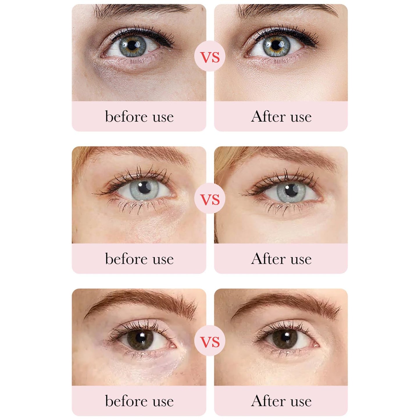 BIOAQUA Rose Hyaluronic Acid Moisturizing Eye Mask Dark Circles Removes Eye Bags Hydration Skin 80g (60pcs/30pairs)