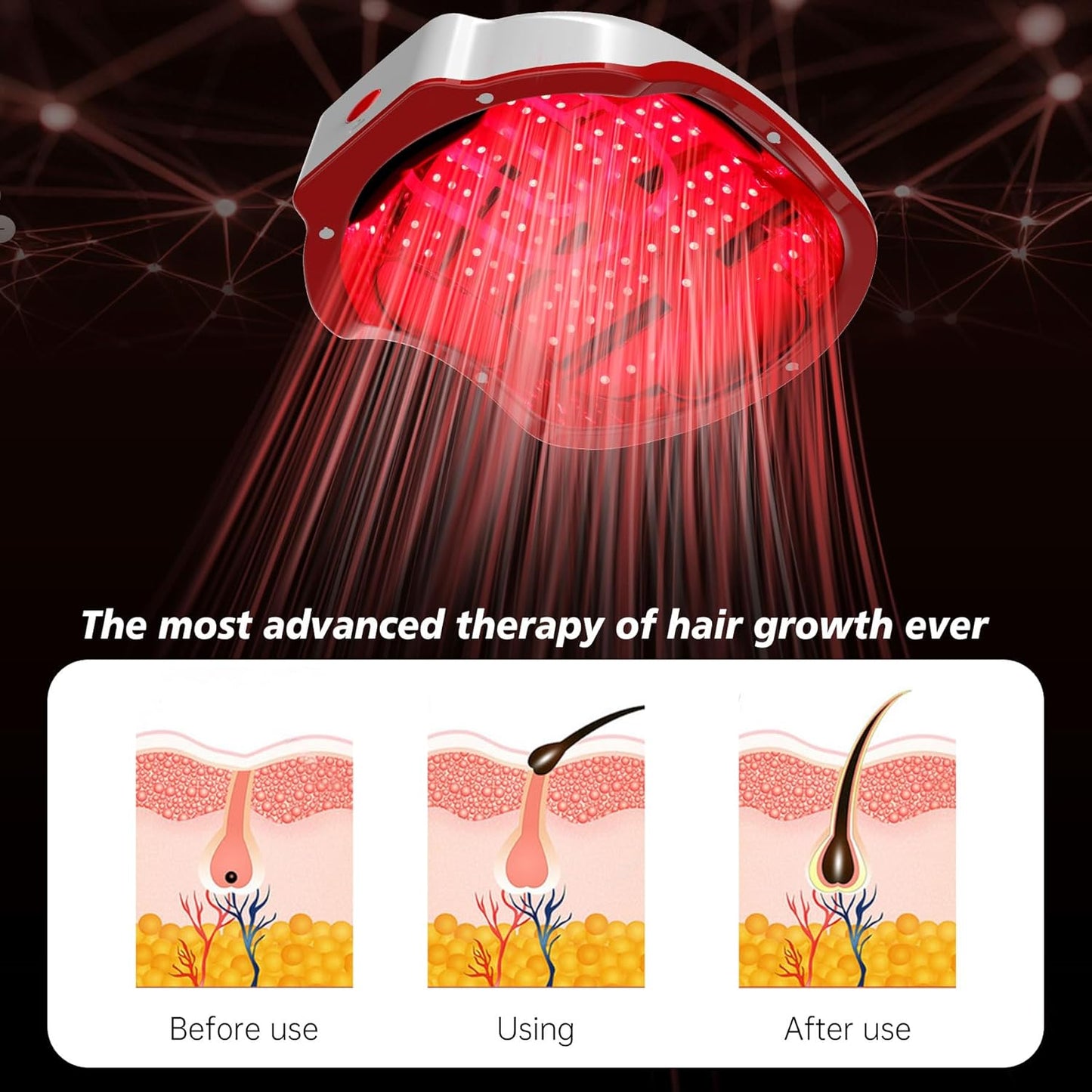 Laser Hair Growth Device, LED Light Therapy Cap, Hair Regrowth Treatment for Men and Women (White)