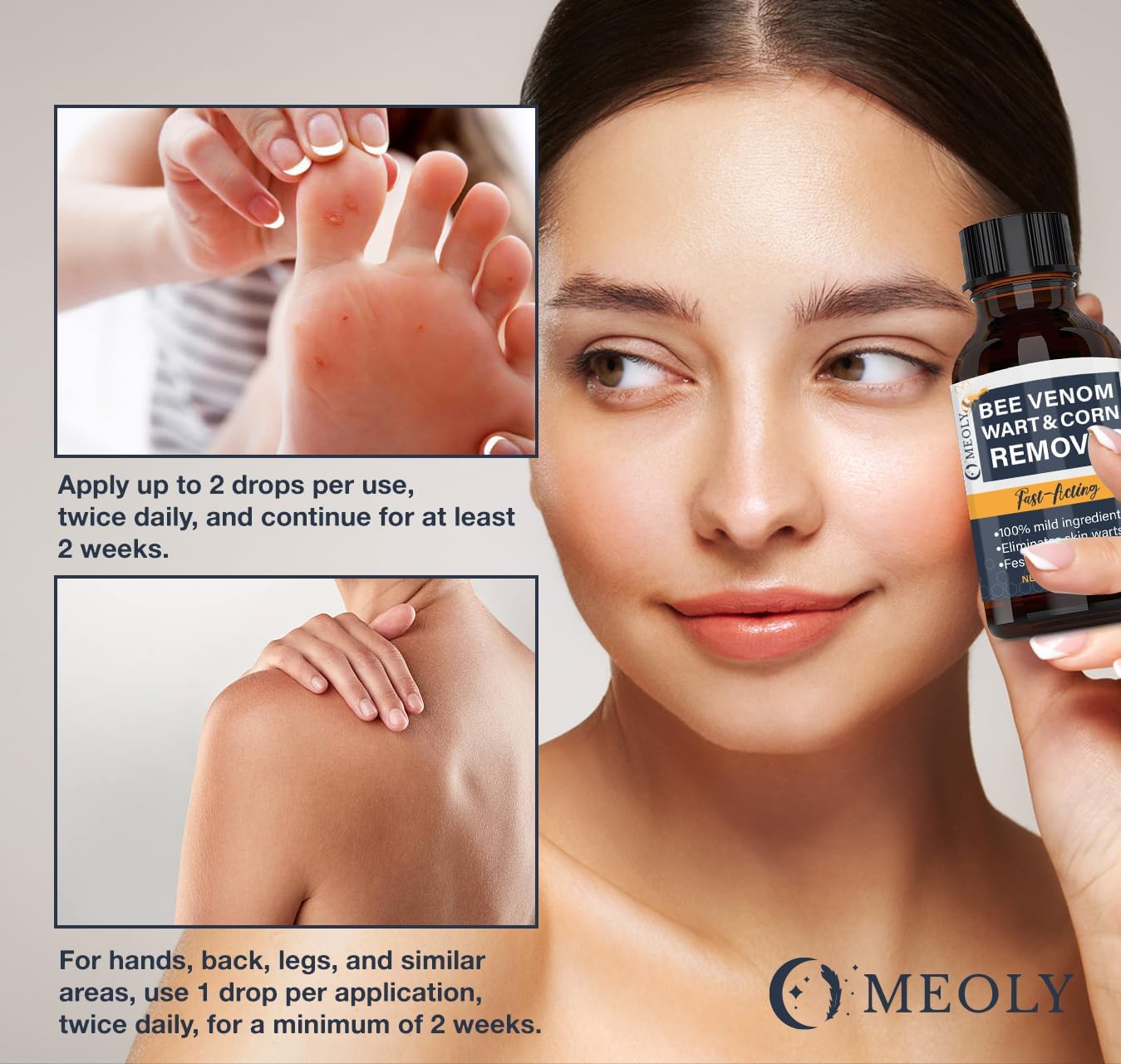 Bee Venom Skin Wart Remover: Fast-Acting 20% salicylic Acid Skin Wart Remover for Plantar Wart, Genital Wart