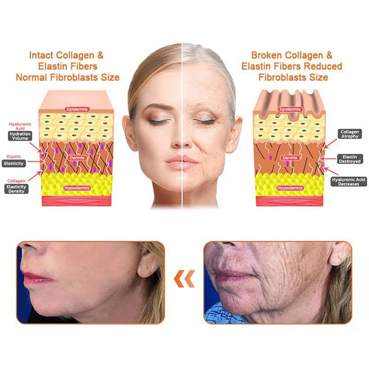 Bee Venom Comprehensive Cream, Professional bee venom cream for Removing and Repair, APKAPK Bee Venom Skin Treatment Cream, Natural Serum Suitable for All Skin Types (3 Pack)