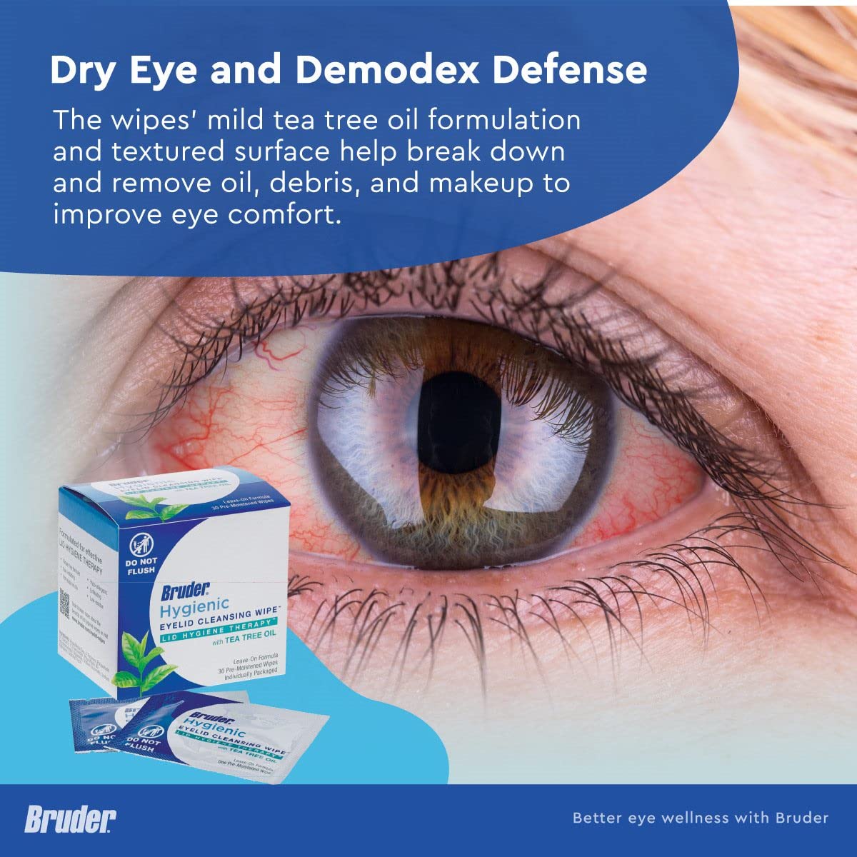 Hygienic Eyelid Cleansing Wipes with Tea Tree Oil l Relief from Demodex l Pre-Moistened, Rinse-Free Exfoliating Wipes Remove Excess Oil and Debris from Eyelids & Lashes l 30 Count Box