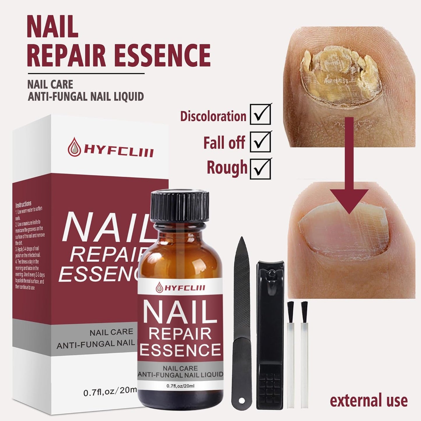 Nail Repair Essence Serum Nail Treatment Multi-Purpose Nail Repair Liquid Solution for Damaged Nails repair for Discolored Nails Ingrown Treatment Extra Strength Nail Care 0.7 Fl Oz