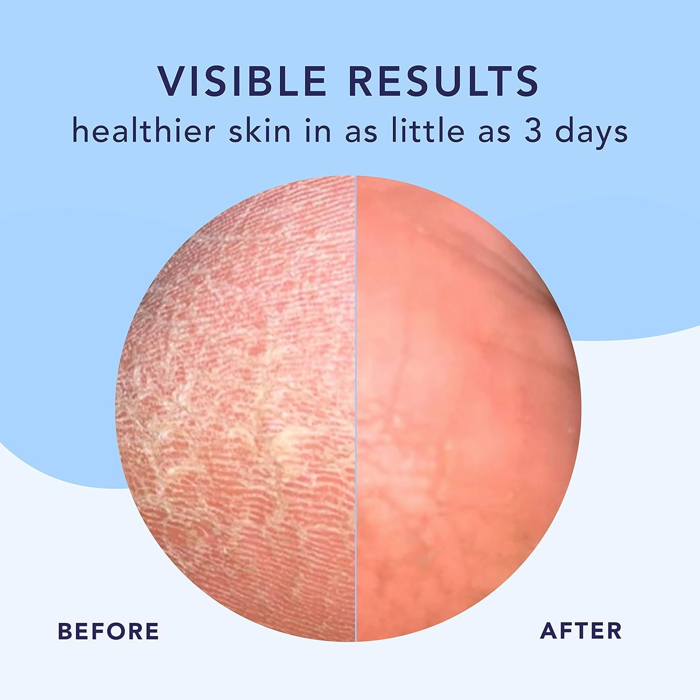 Barefoot Scientist High Dive Intensive Hydration Foot Therapy Cream, Specialized Moisture for Dry Feet and Cracked Heels