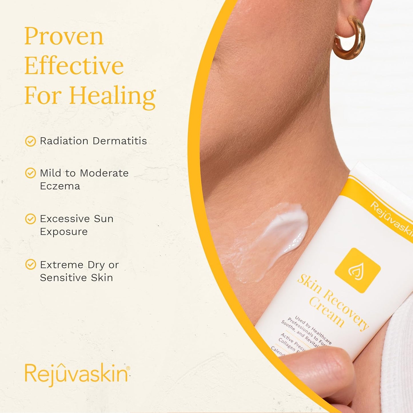 Rejuvaskin Skin Recovery Cream with Aloe Vera, Cooling Moisturizing Cream for Dry, Itchy & Sensitive Skin, 100 ml