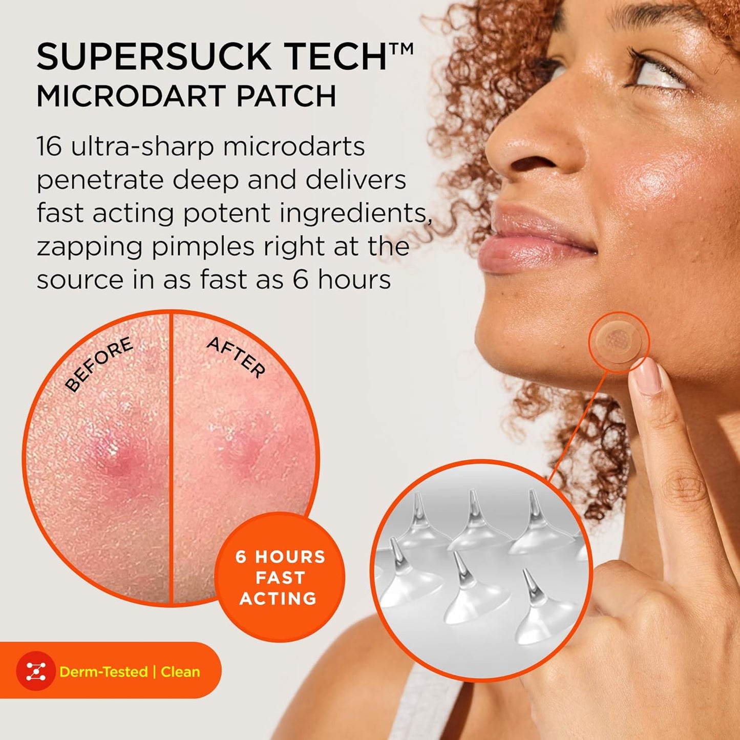 ZitSticka Killa Pimple Patches for Face - World's Most Potent Pimple Patch with Fast-Acting Microdarts - Starts Working within 26 Hours for Deep, Early-Stage Zits - Mini 24 Count