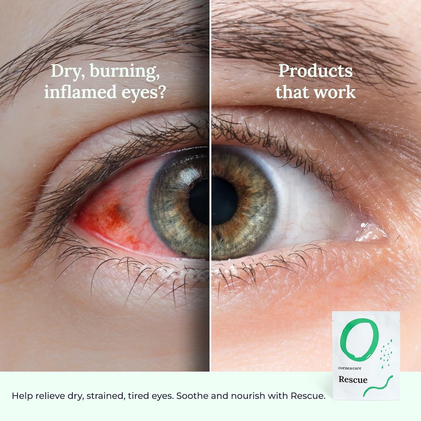 Rescue: Hydrogel Self Cooling Compress | Cold Eye Masks for Puffy Eyes | Self Cooling Eye Compress for Fast Relief | Travel Ready | 12 Count