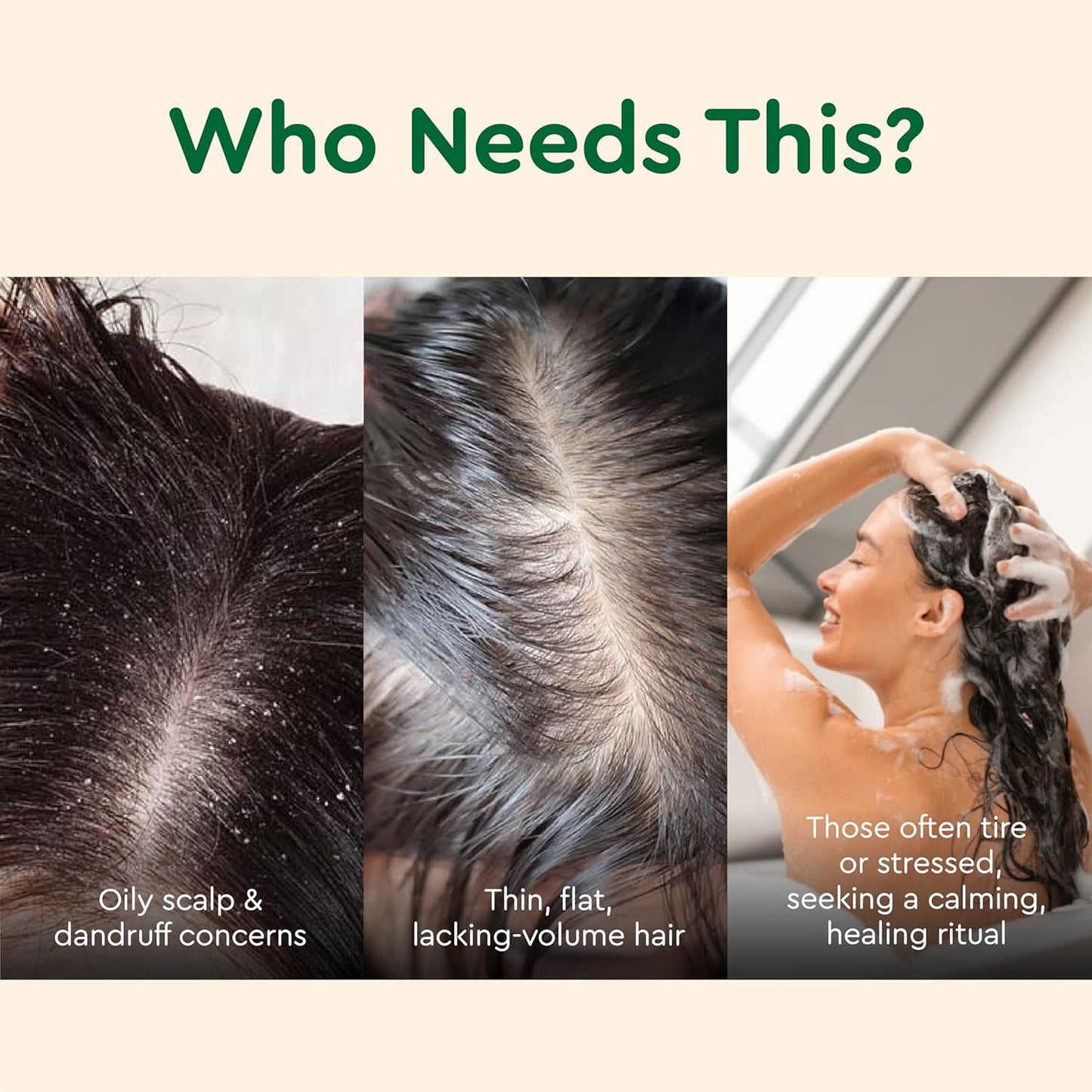 Vietnam's Touch | COCAY HOALA Ginger Lemongrass Shampoo and Conditioner Set for Hair Growth – Moisturizing & Soft Hair, Deep Cleansing for Oily Roots – Paraben Free (17.64 oz, 2 Pack)