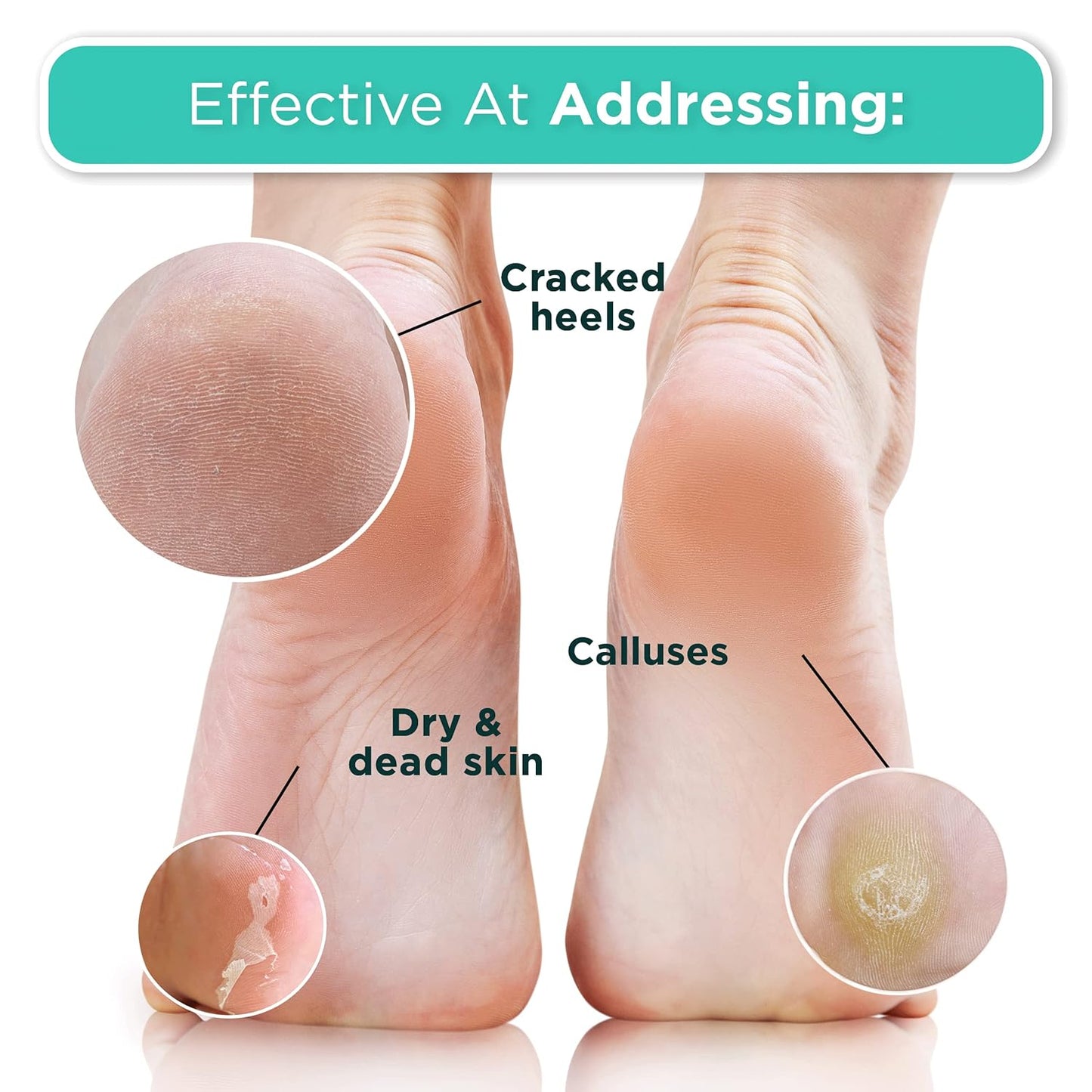 DERMORA Foot Peel Mask - 2 Pack of Regular Size Skin Exfoliating Foot Masks for Dry, Cracked Feet, Callus, Dead Skin Remover for Baby Soft Feet, Lavender Scent