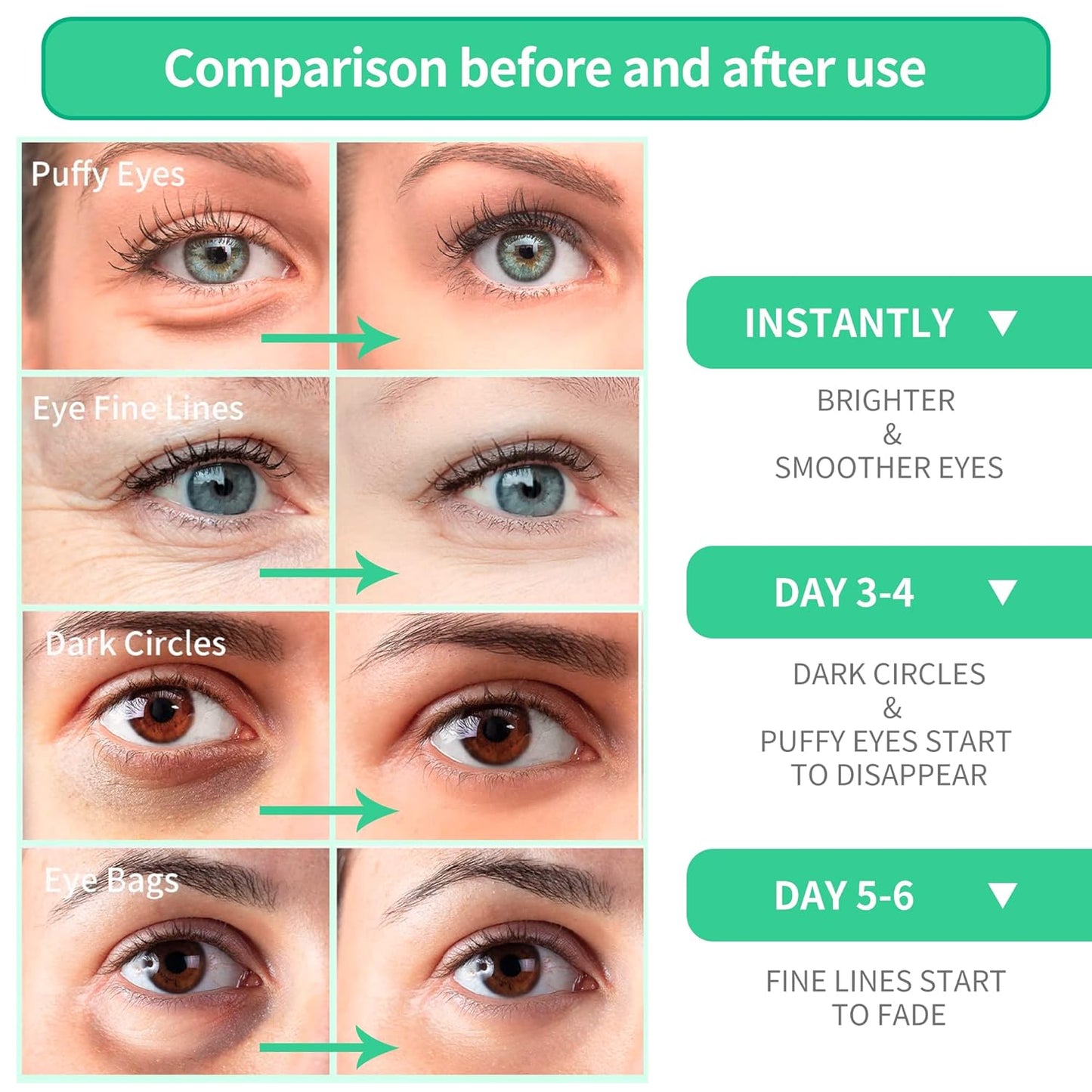 BREYLEE Aloe Vera Eye Masks 60 Pcs-eye Masks with Calming and Hydrating Ingredients, Improve and Firm eye Skin,Under Eye Patches,Eye Patches For Puffy Eyes,Multiple Plant Essences