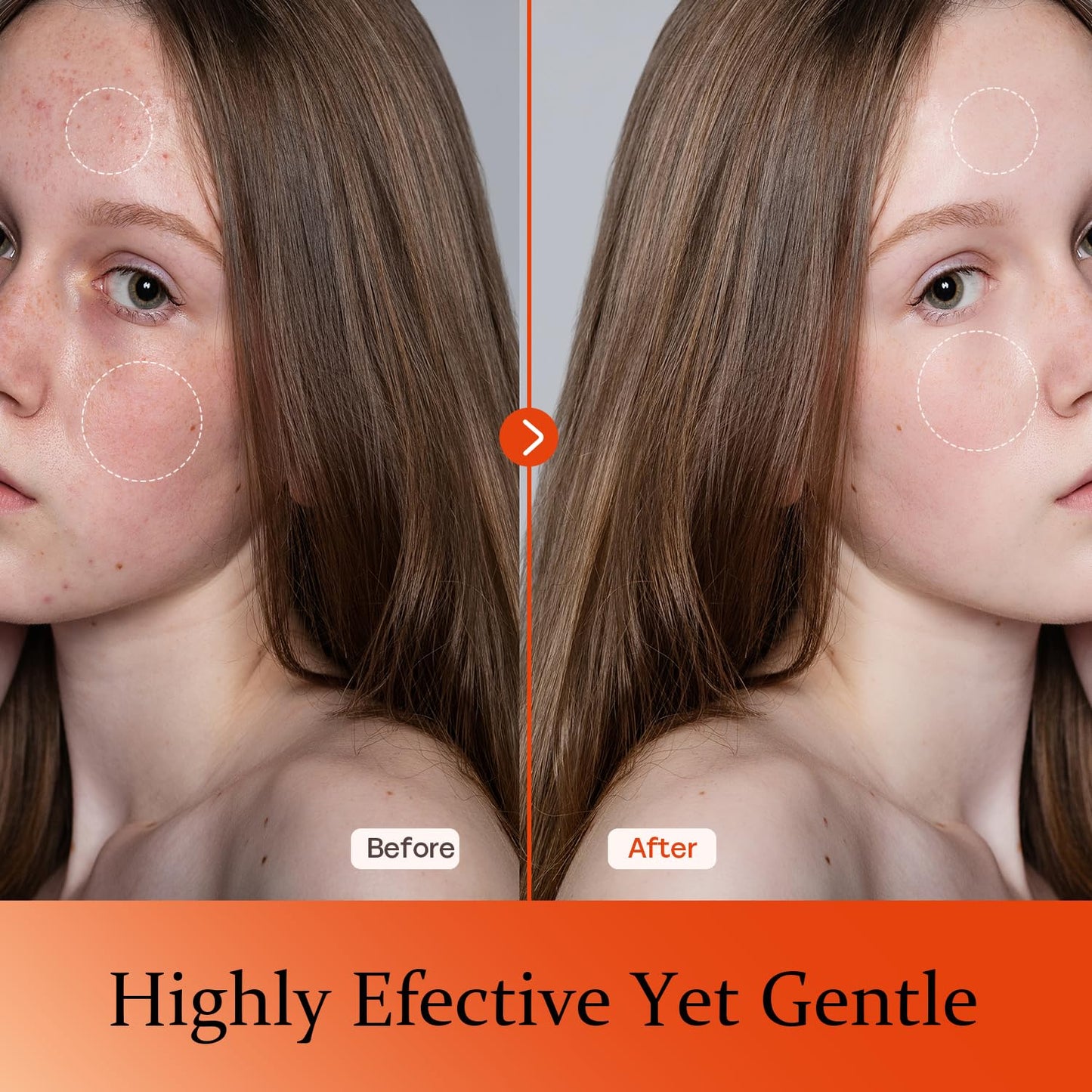 Vitamin C Serum For Face-Anti Aging & Wrinkle Facial Serum With Vitamin C,Sodium Hyaluronate,Vitamin E And More,Skin Brightening Serum For Dark Spots,Fine Lines & Dull Skin,1 Fl Oz