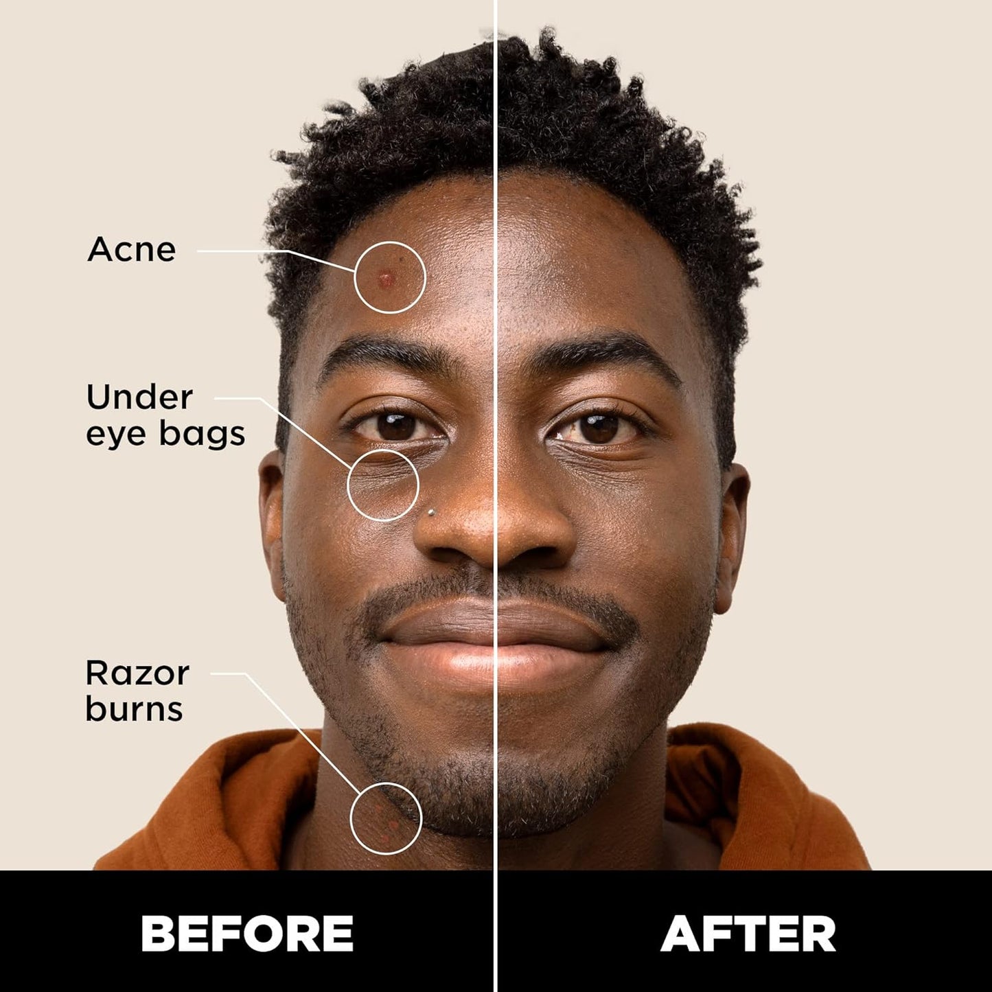 Stryx Concealer Stick Tool for Men, Deep Java - Natural Pigments Hides Imperfections, Acne, Razor Burns, Scars, & Rosacea - Highly Adaptable Shades for Easy, Undetectable Coverage - All Skin Tones