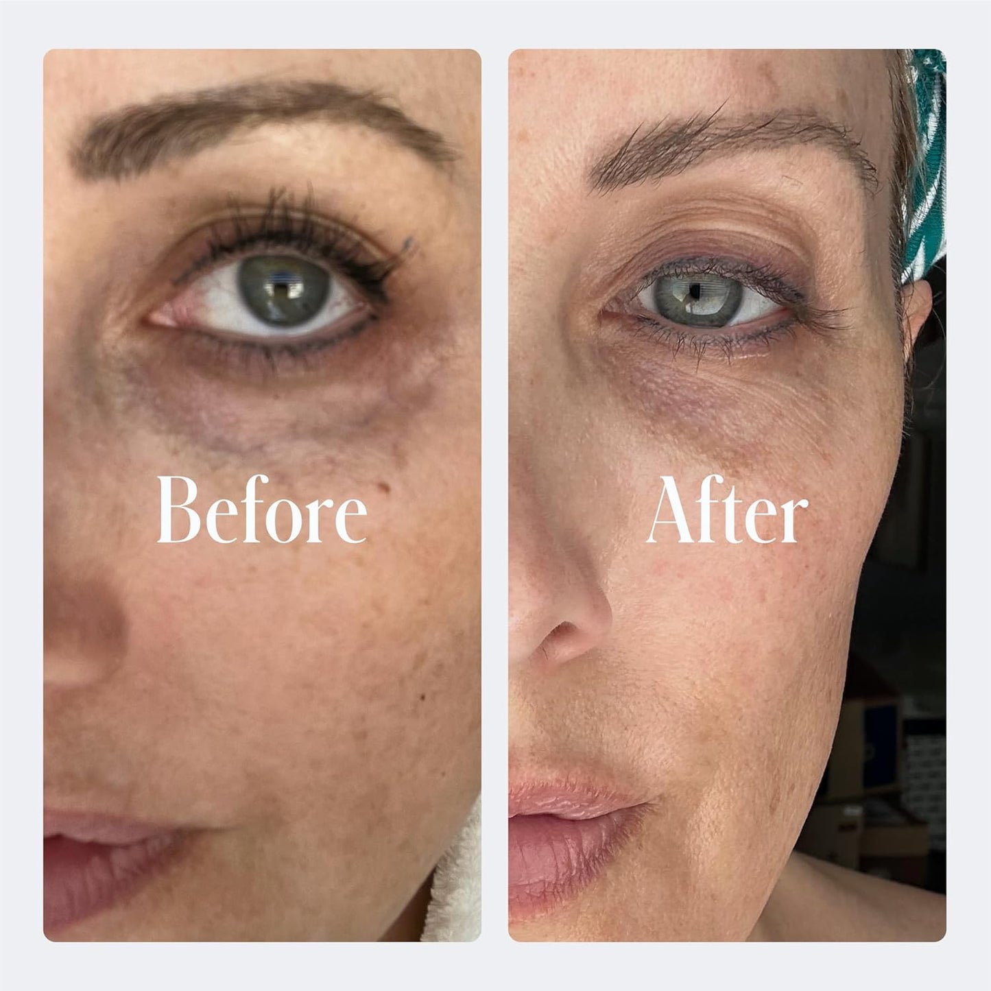 Geologie Dark Circle Under Eye Cream | Formulated to Help Dark Circles, Puffy Eyes Fine Lines & Wrinkles | Kojic Acid, Caffeine, Peptides, Niacinamide & Hyaluronic Acid