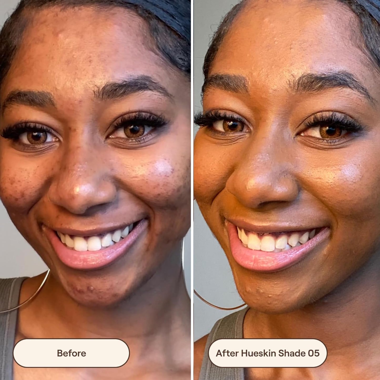 Live Tinted Hueskin Serum Concealer - Medium-to-Full Coverage Concealer with Niacinamide, & Hyaluronic Acid for Dark Circles, Fine Lines & Wrinkles, Buildable Long-Lasting Formula, 0.35 oz - Shade 5