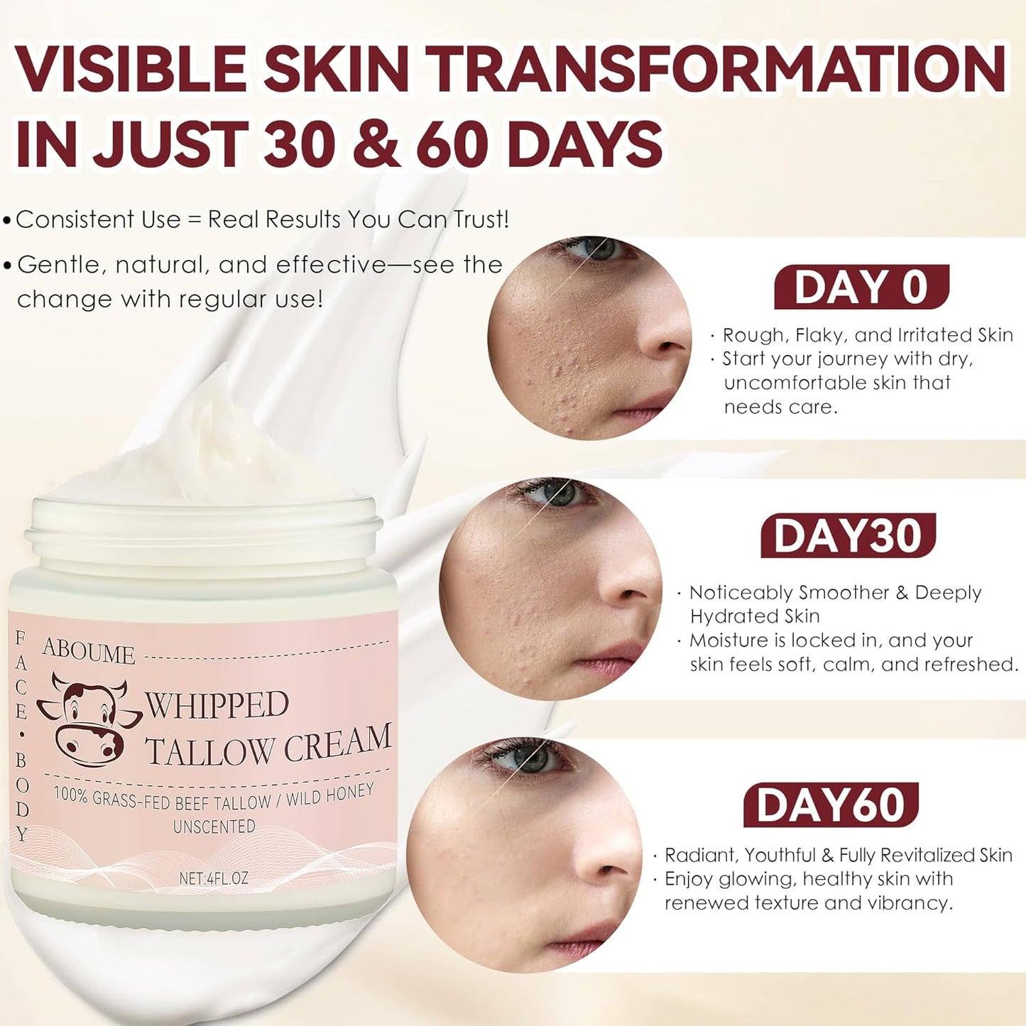 Beef Tallow for Skin, 100% Grass-Fed Whipped Beef Tallow and Honey Balm with Wild Honey & Beeswax, Face & Body Moisturizer Cream for Sensitive Skin 4 FL.OZ