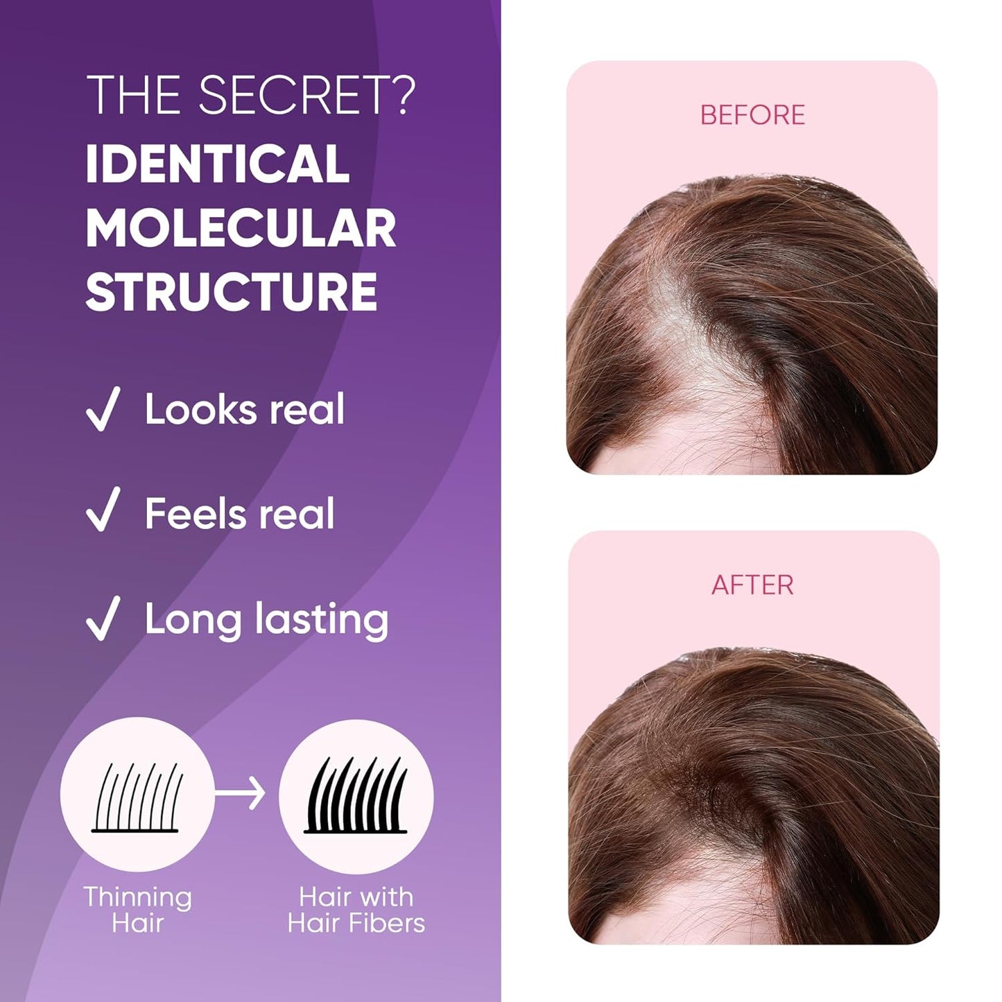 GBG Hair Fibers for Thinning Hair & Bald Spots (Dark Blonde) - 25g Bottle - Conceals Hair Loss - Instant Cover Up & Volume in 30 Seconds, Hair Powder for Women & Men - Cruelty Free