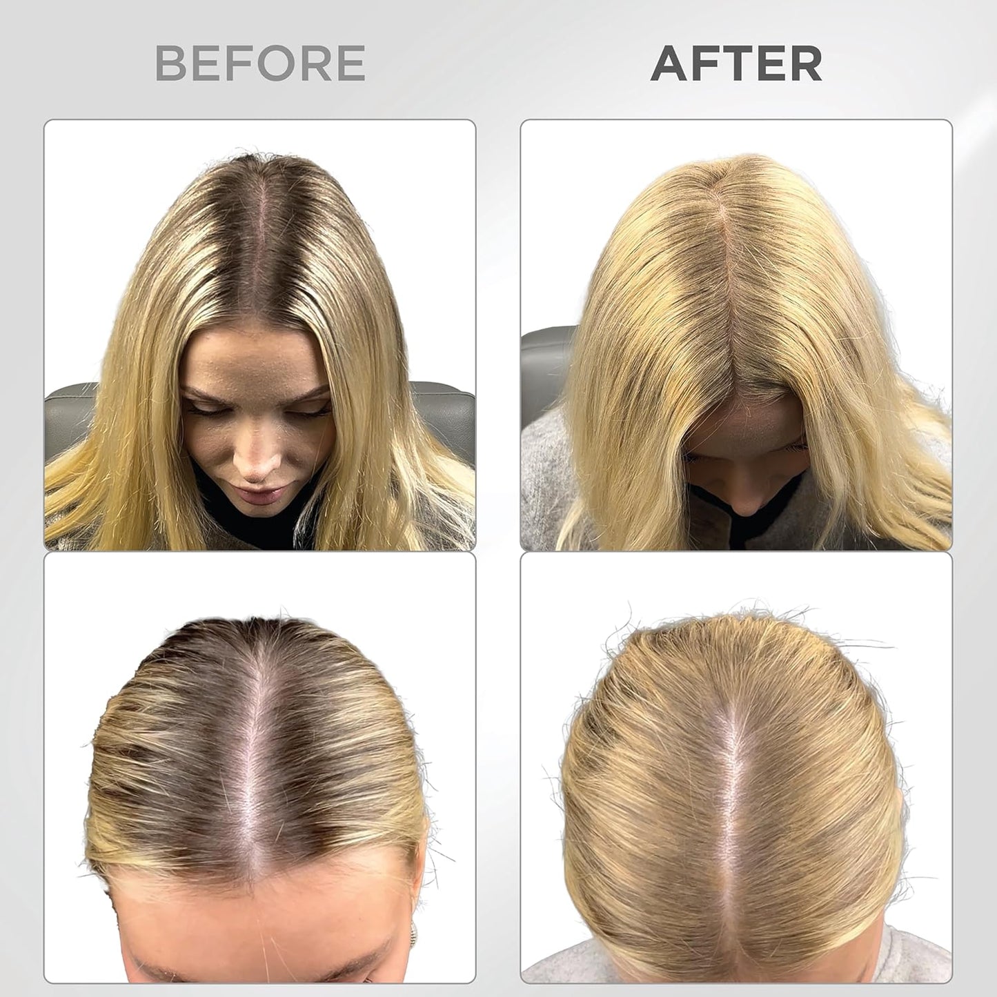 THICK FIBER Root Touch Up Powder for Thinning Hair Women - Water & Sweat Resistant Hair Loss Concealer Set with Brush (Blonde)