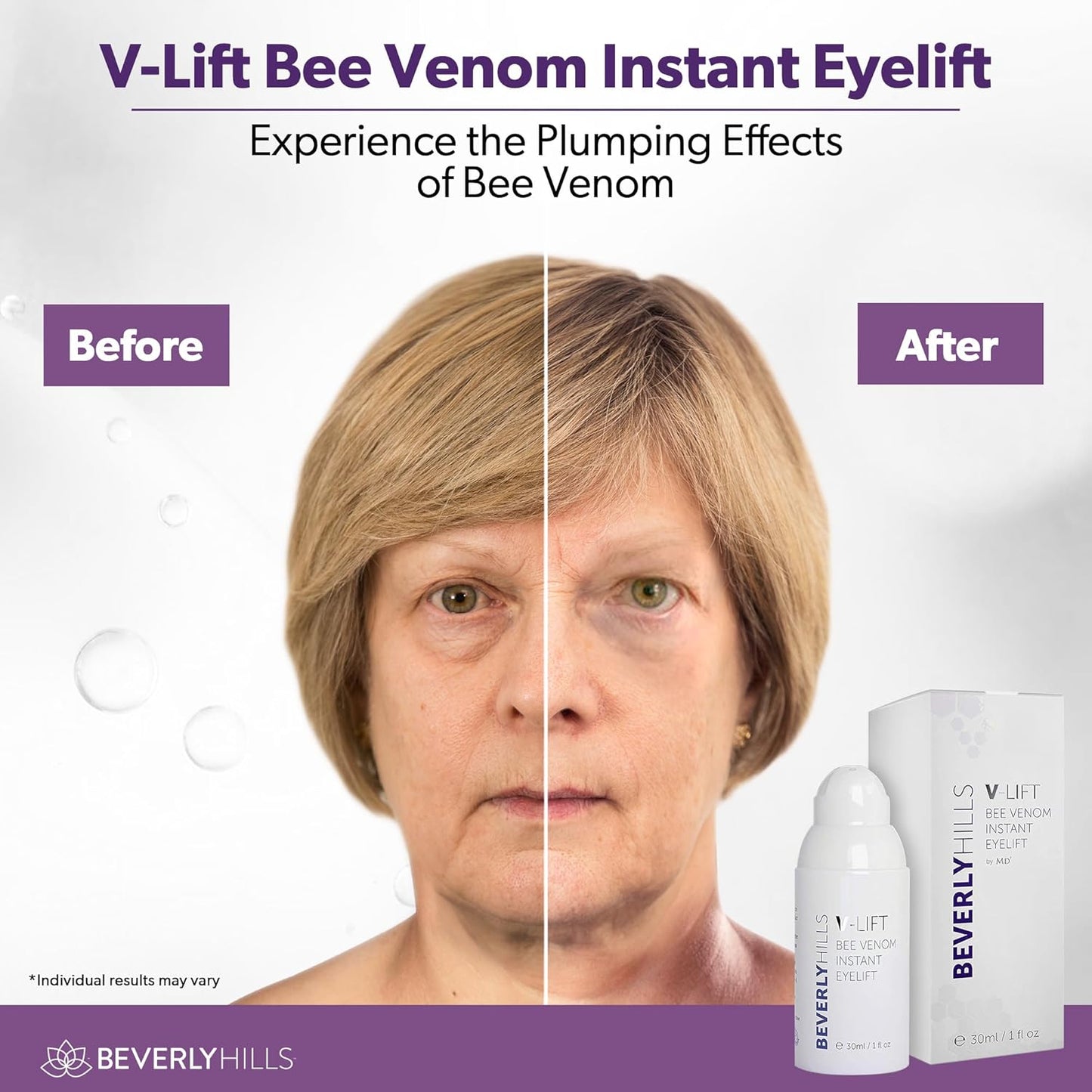 Beverly Hills V-Lift Instant Eye Lift and Eye Tuck Bee Venom Serum for Puffy Eyes, Dark Circles, Wrinkles, and Under Eye Bags Treatment for Women and Men | 30mL (120 Day Supply)