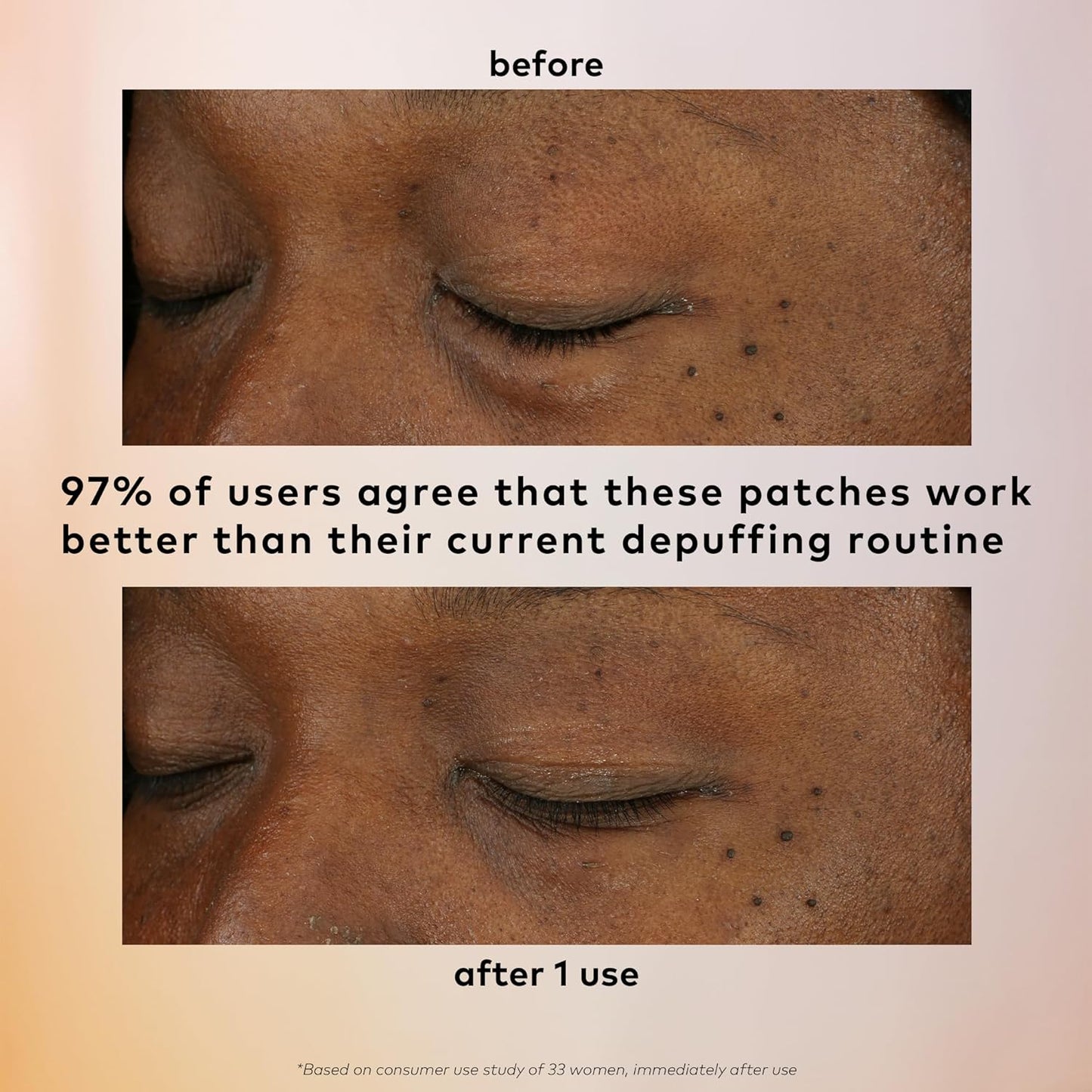 The Good Patch De-Puff Cooling Hydrogel Under Eye Patches for Puffy Eyes and Under Eye Bags, Made with Caffeine, Aloe Vera, Gotu Kola, Clinically Proven (18 Total Patch Sets)