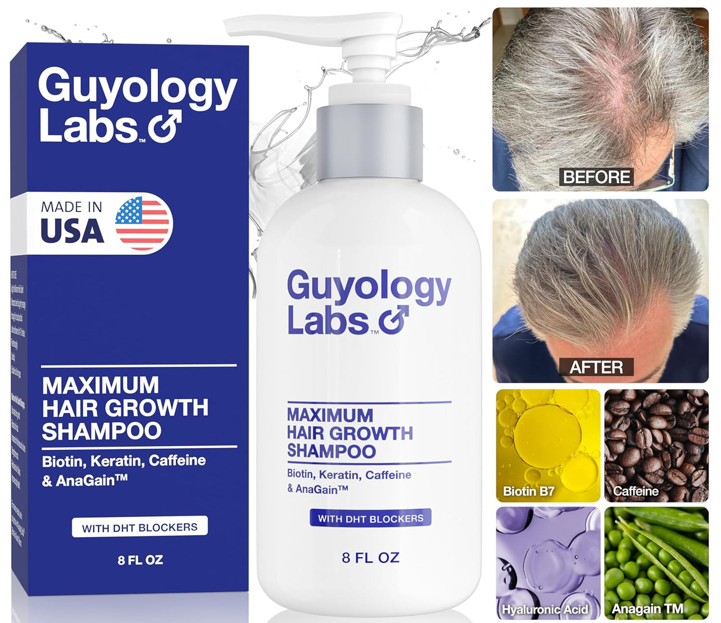 Hair Growth Shampoo For Men - for Thinning Hair - Natural DHT Blockers To Reduce Hair Loss - Biotin and Keratin Best for Growth and Thickening - Clinically Tested - Made in USA by Guyology Labs