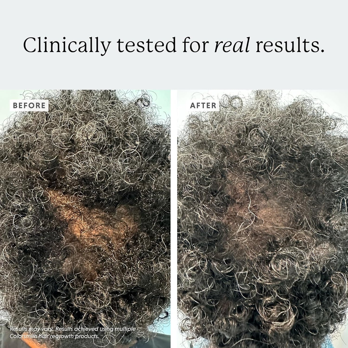 Soothing Scalp Serum, Biotin and Copper Tripeptide Formula, Antioxidant-Rich, 1 fl oz